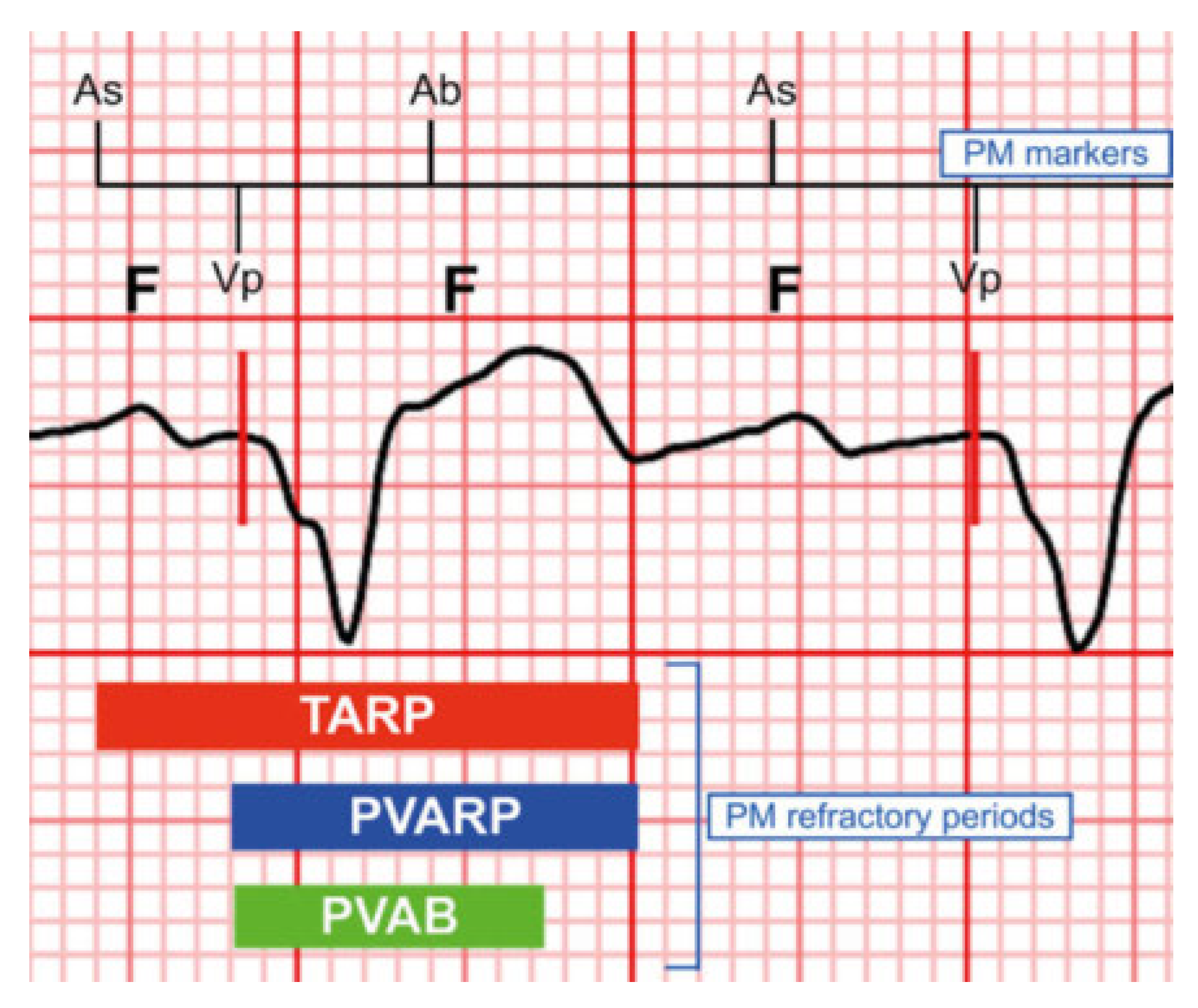 Cardiovascmed 25 00056 g005