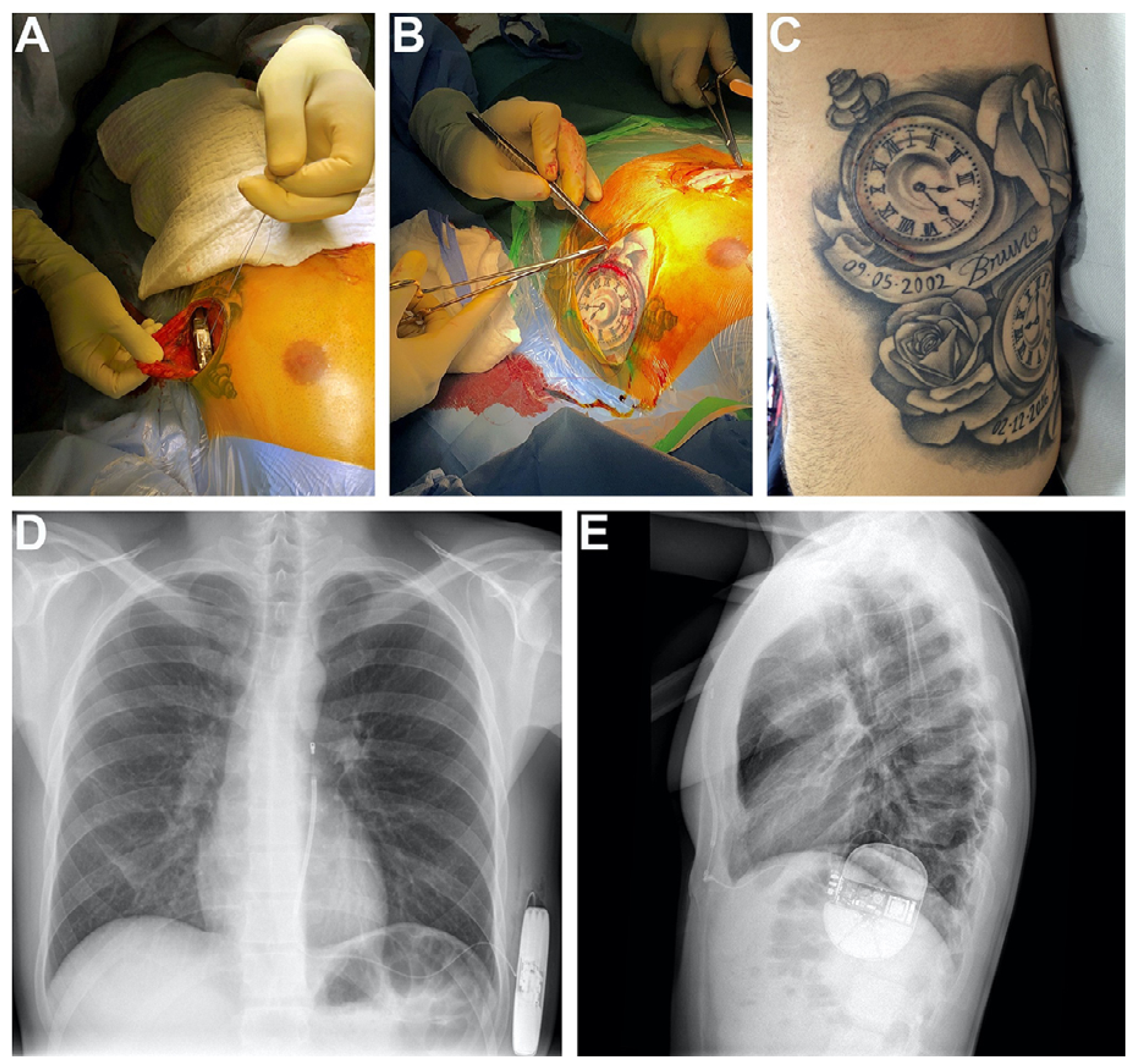 Cardiovascmed 25 00090 g001