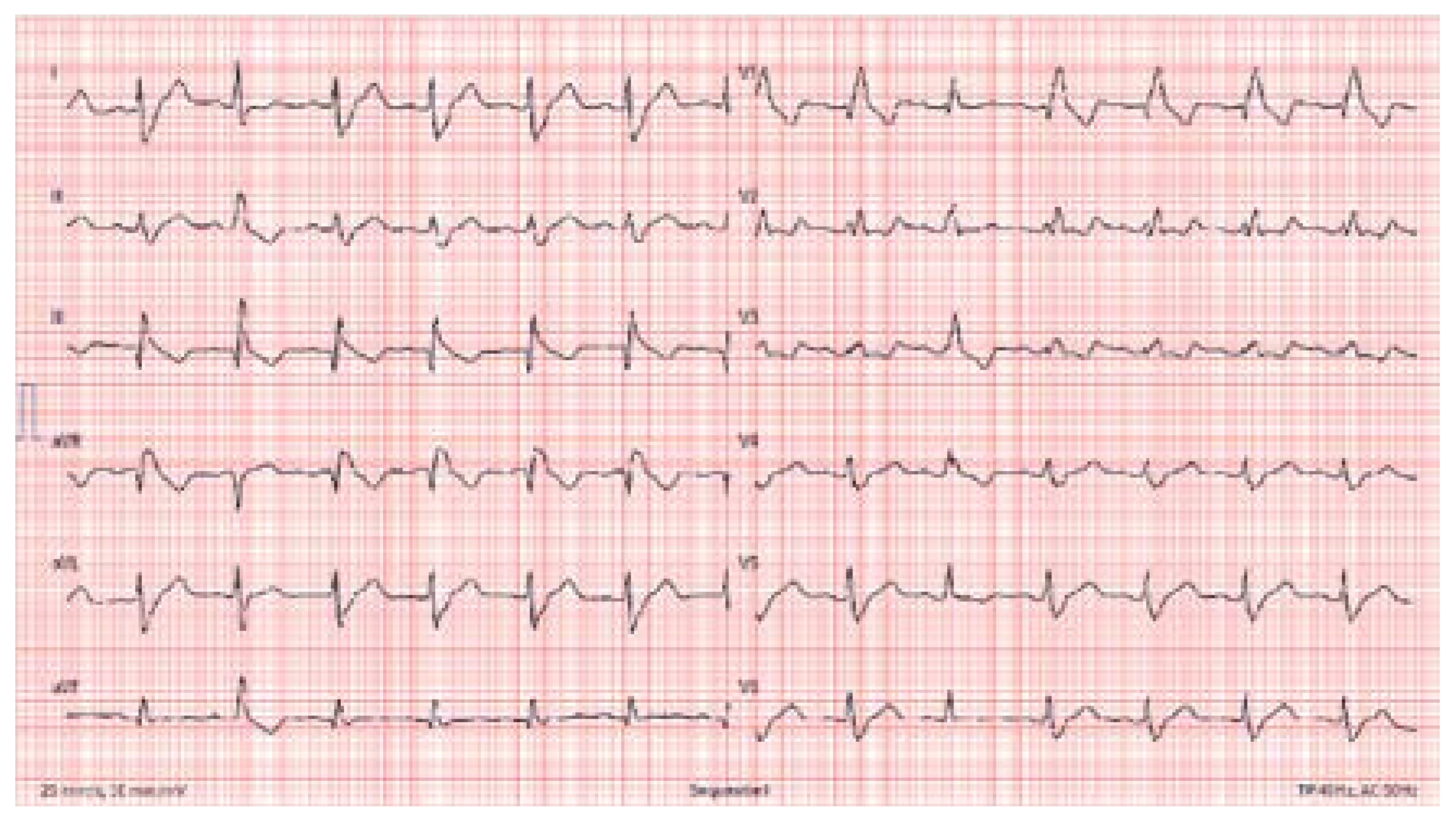 Cardiovascmed 25 00124 g001 Cardiovascmed 25 00124 g001