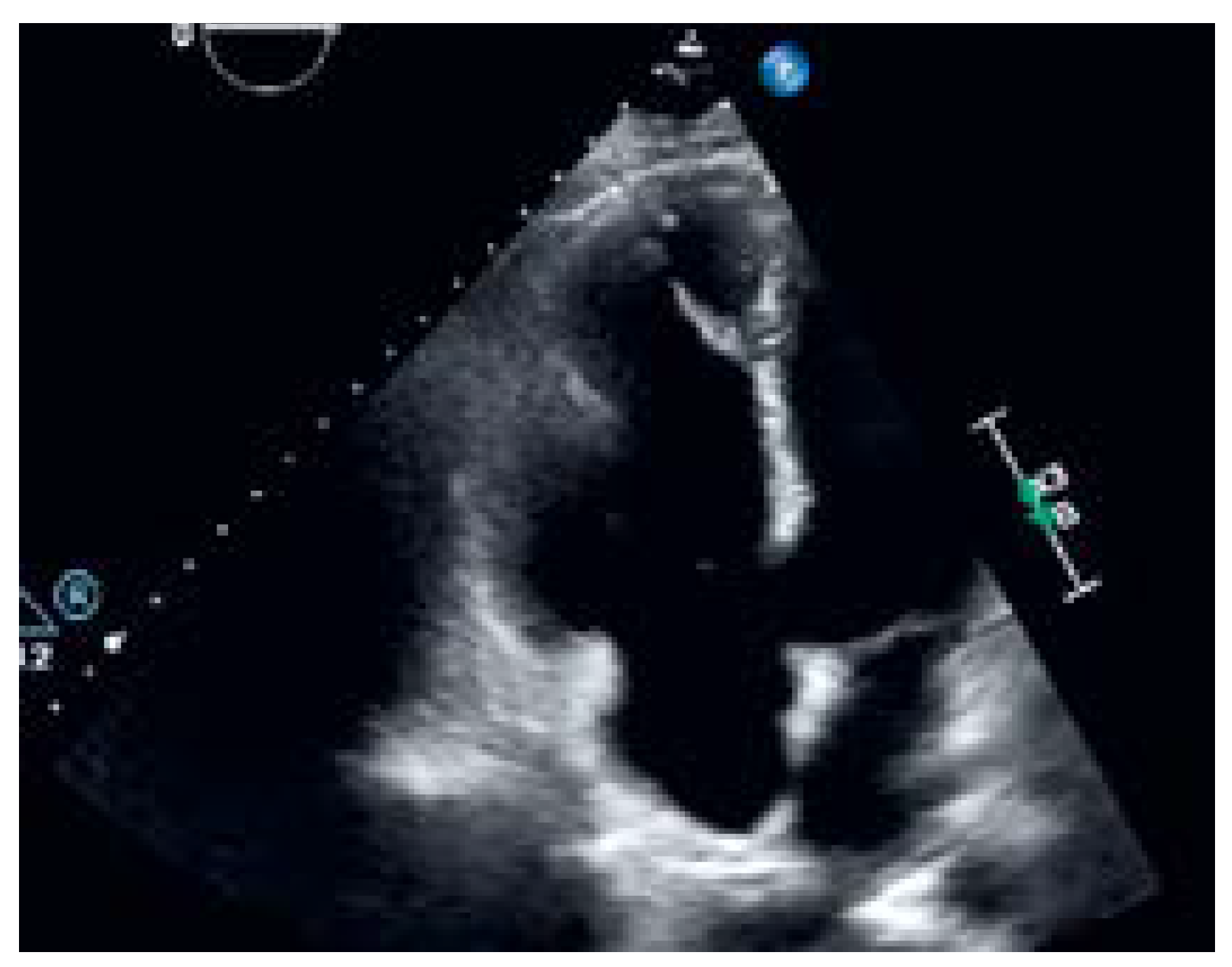 Cardiovascmed 25 00124 g002 Cardiovascmed 25 00124 g002