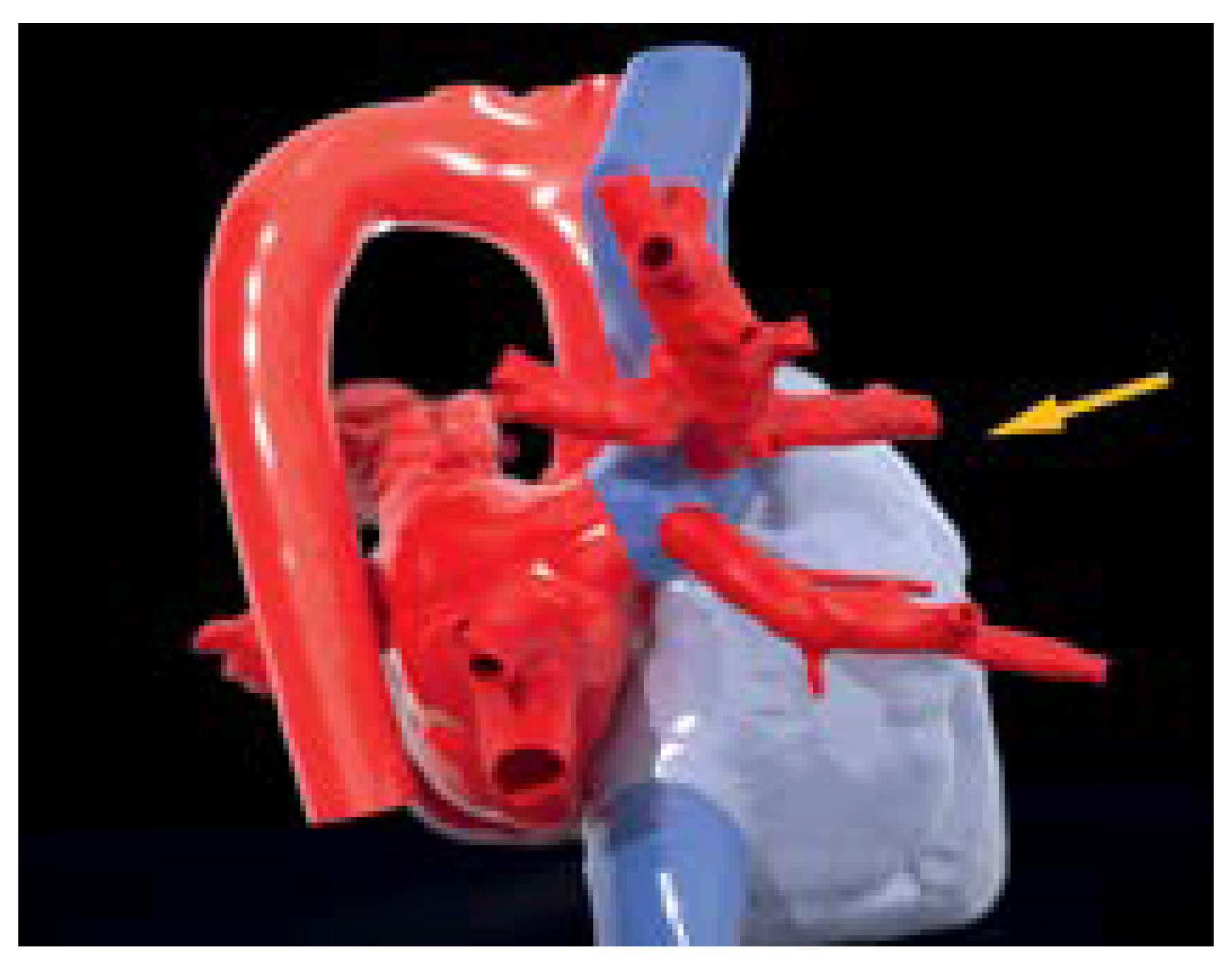 Cardiovascmed 25 00124 g006 Cardiovascmed 25 00124 g006