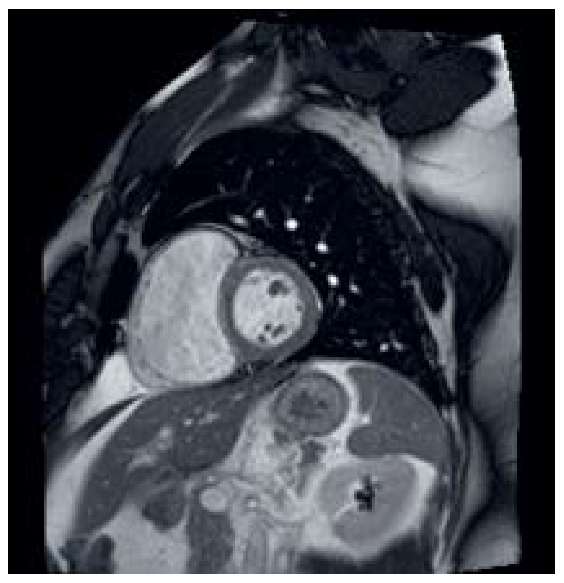 Cardiovascmed 25 00124 g007 Cardiovascmed 25 00124 g007