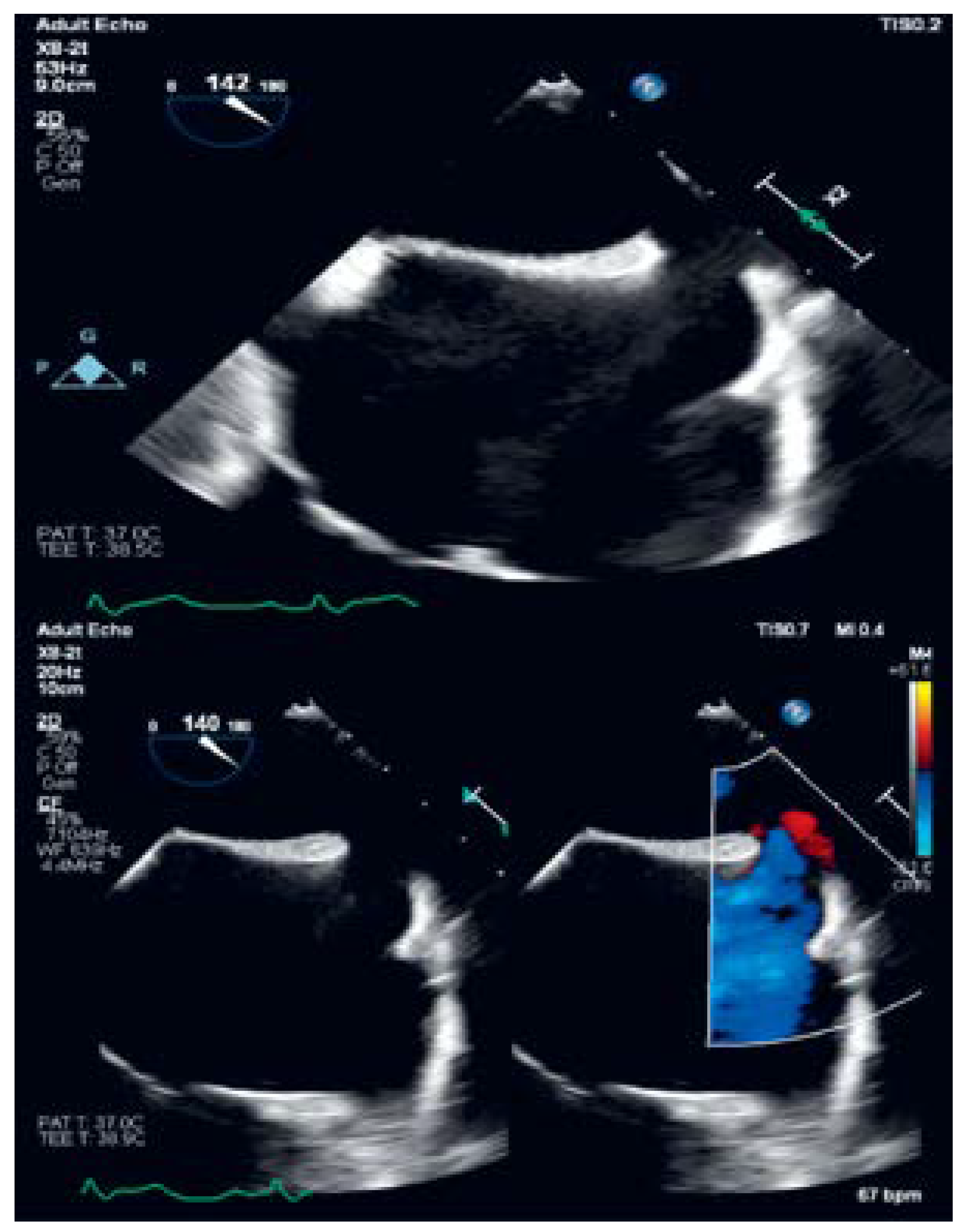 Cardiovascmed 25 00124 g008 Cardiovascmed 25 00124 g008