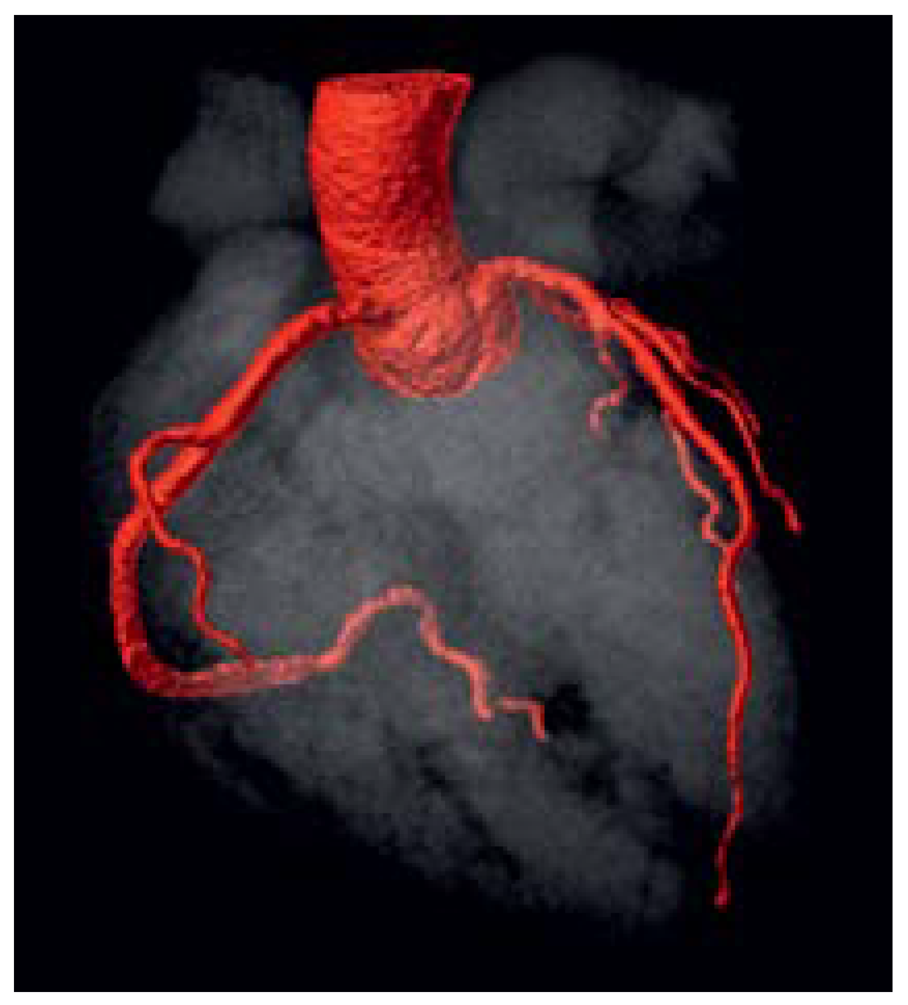 Cardiovascmed 25 00124 g010 Cardiovascmed 25 00124 g010