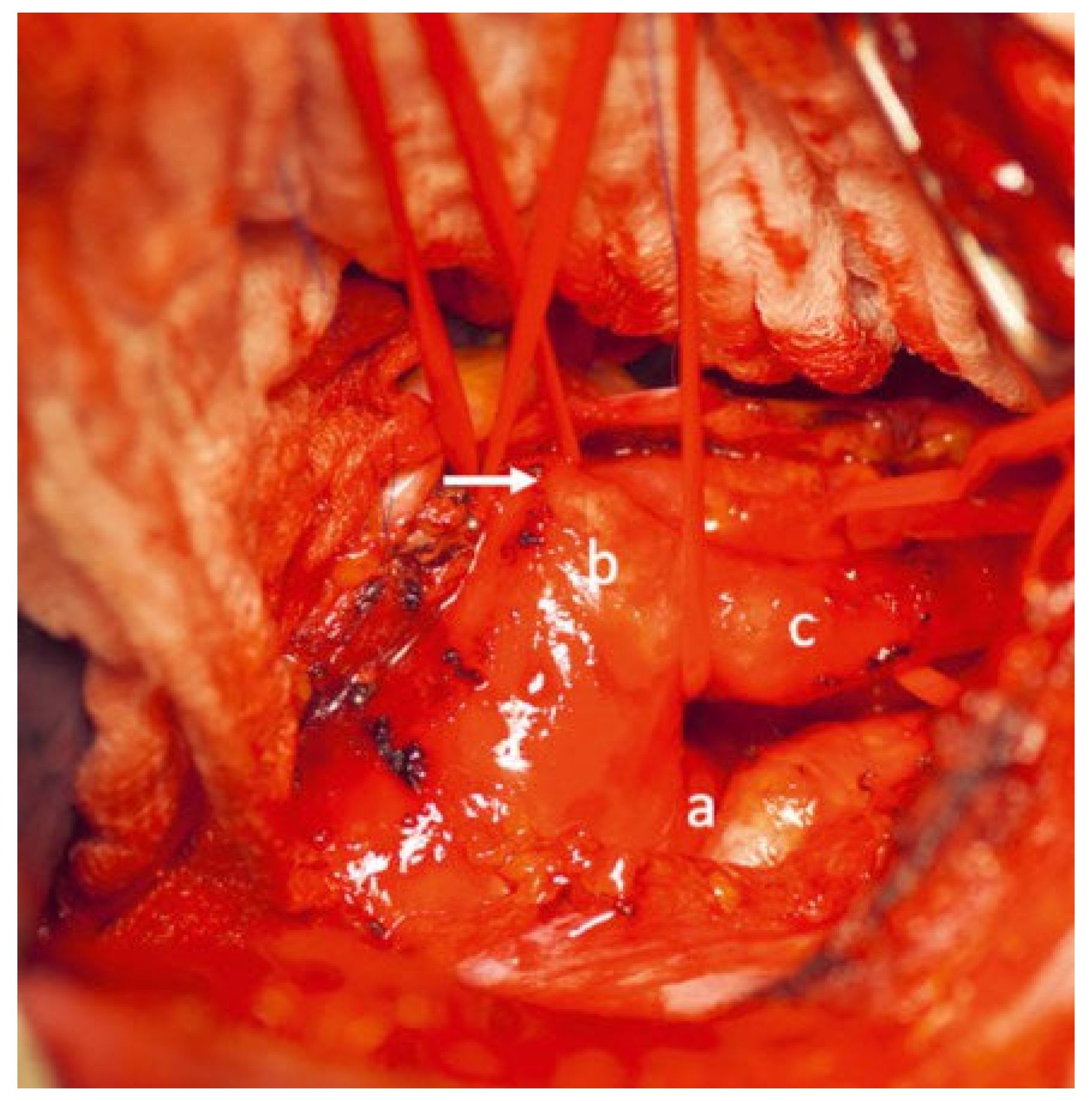 Cardiovascmed 25 00143 g002