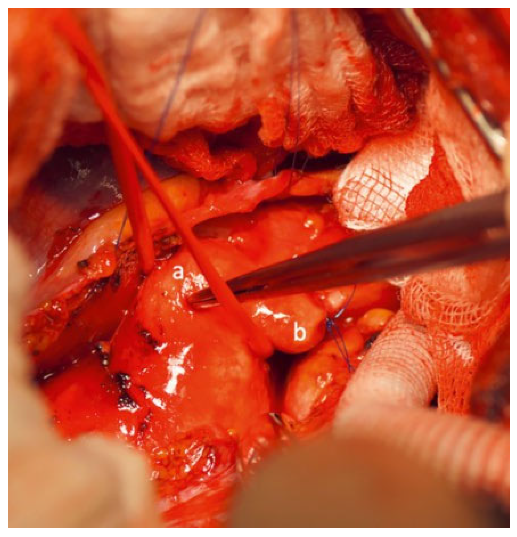 Cardiovascmed 25 00143 g003