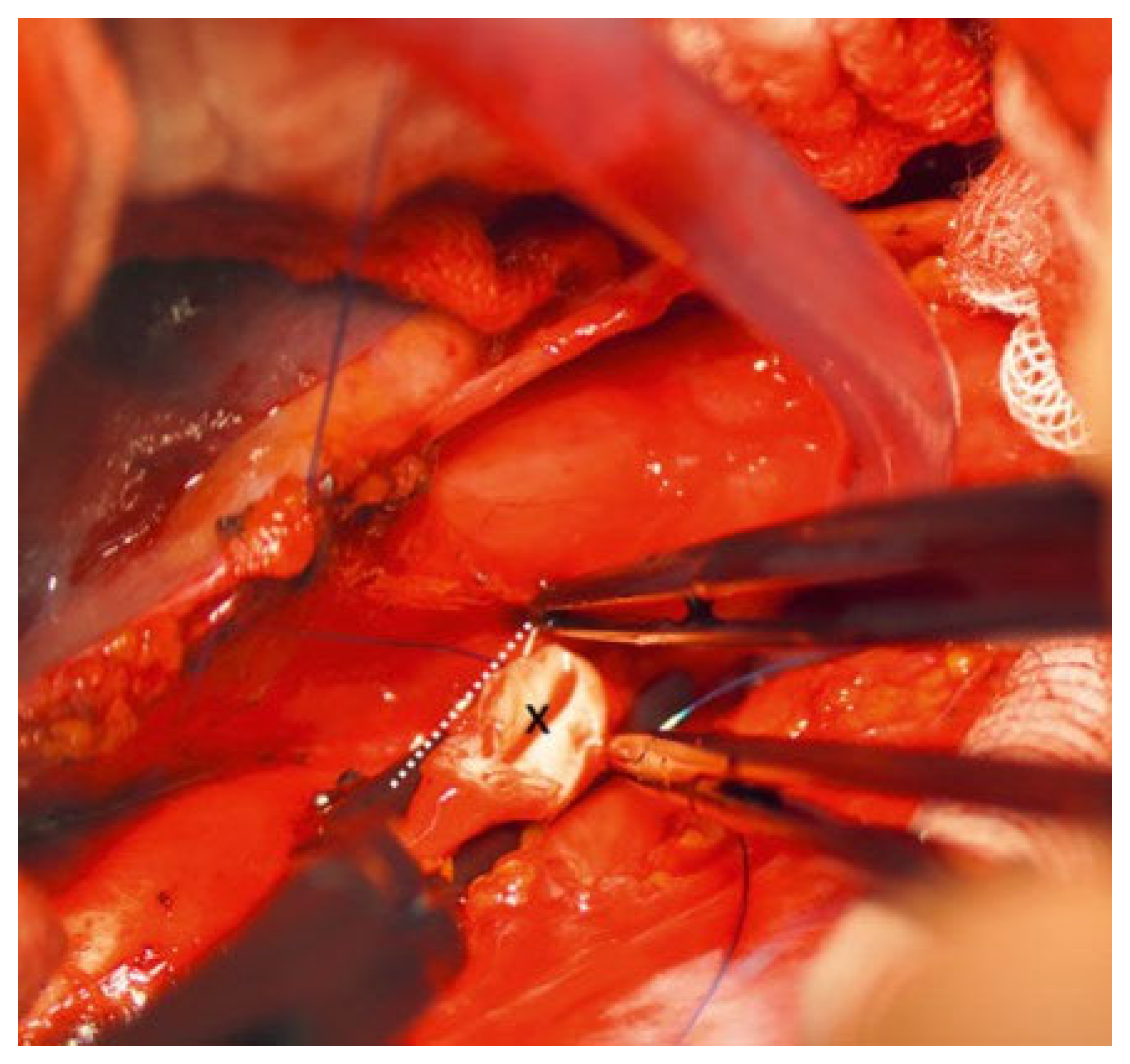 Cardiovascmed 25 00143 g004