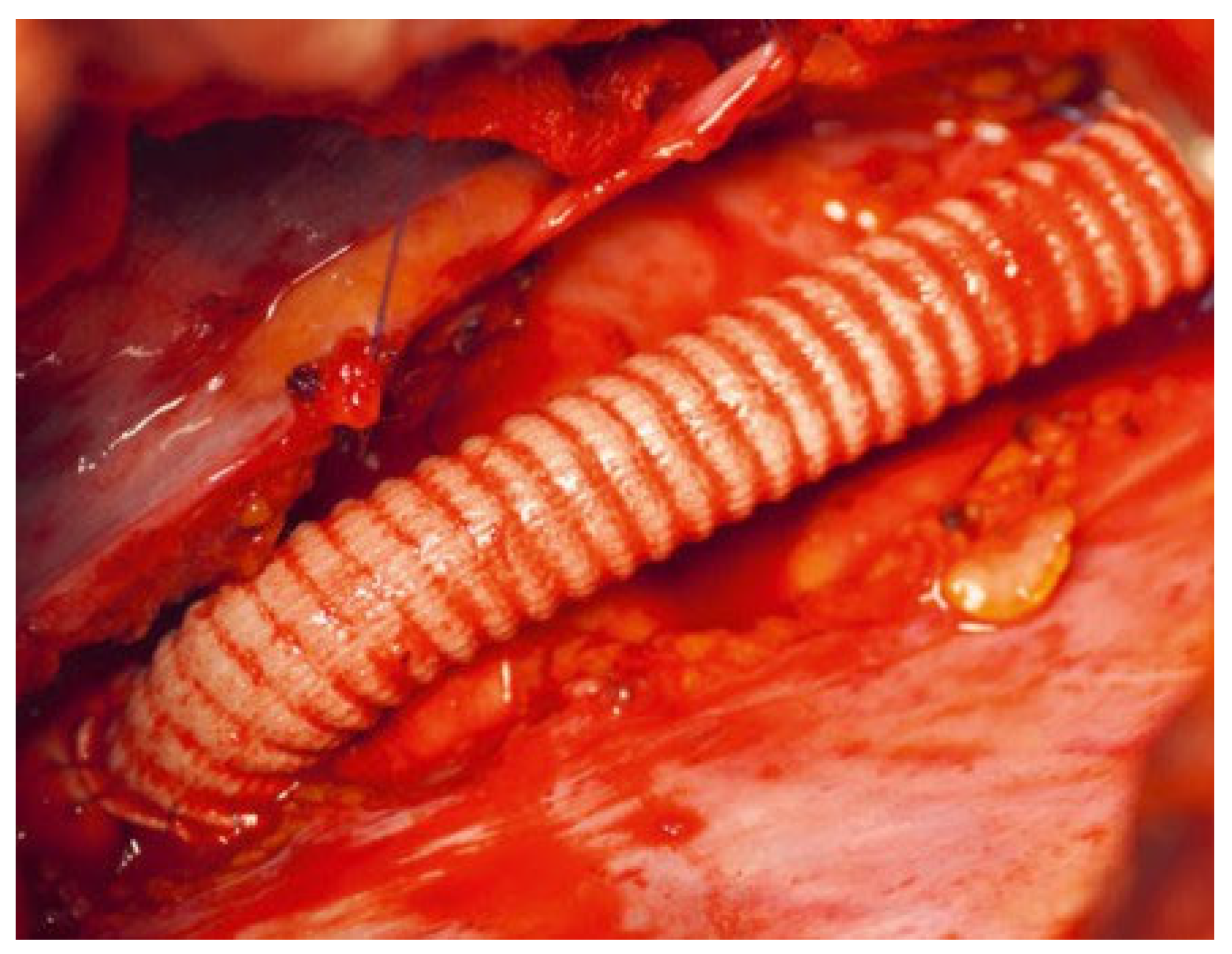 Cardiovascmed 25 00143 g006