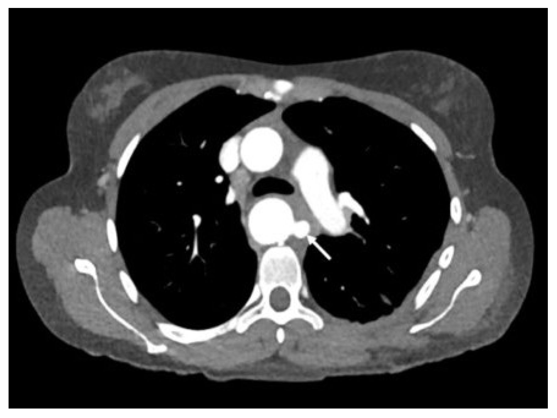 Cardiovascmed 25 00143 g008