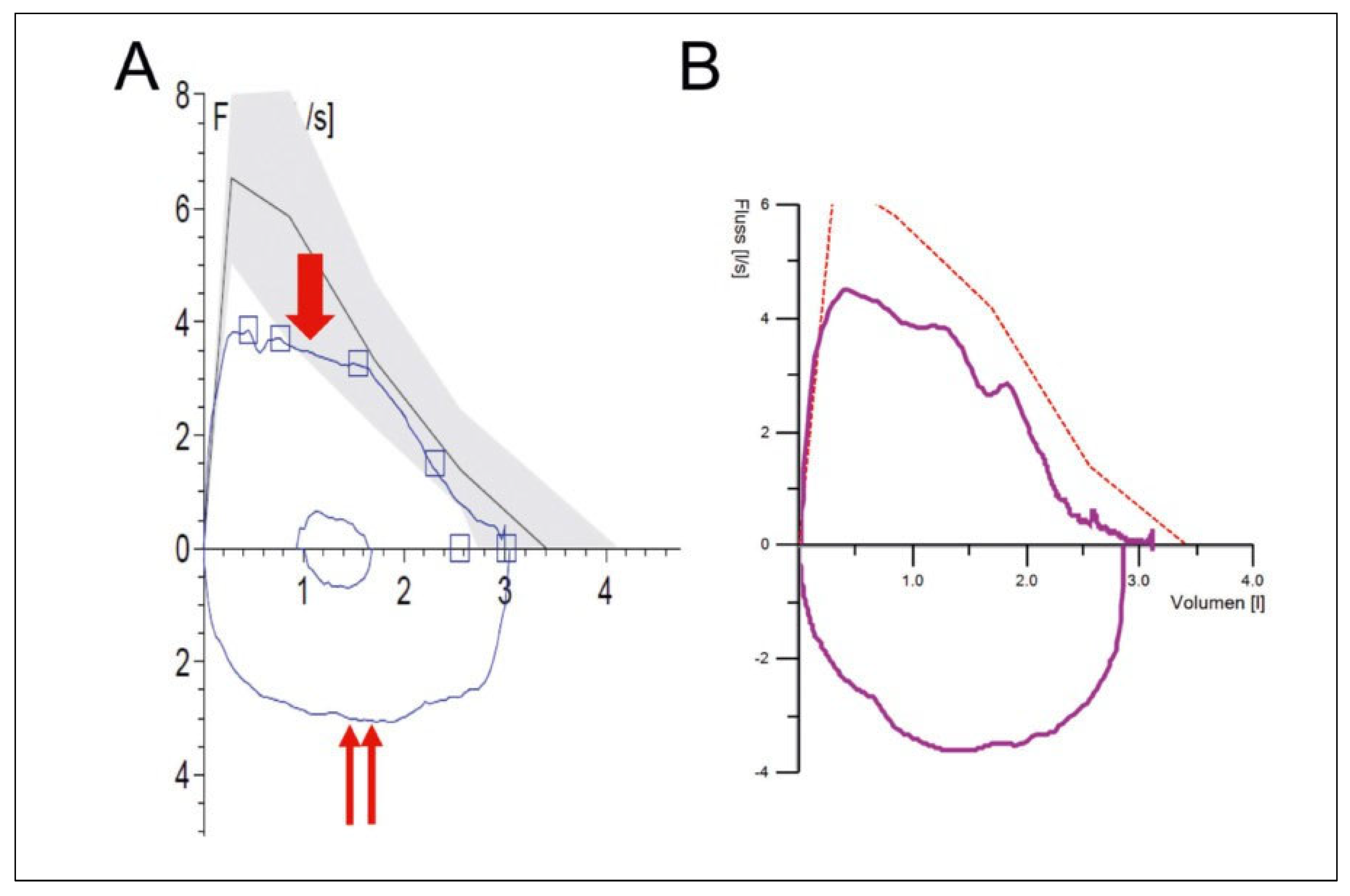 Cardiovascmed 25 00143 g009