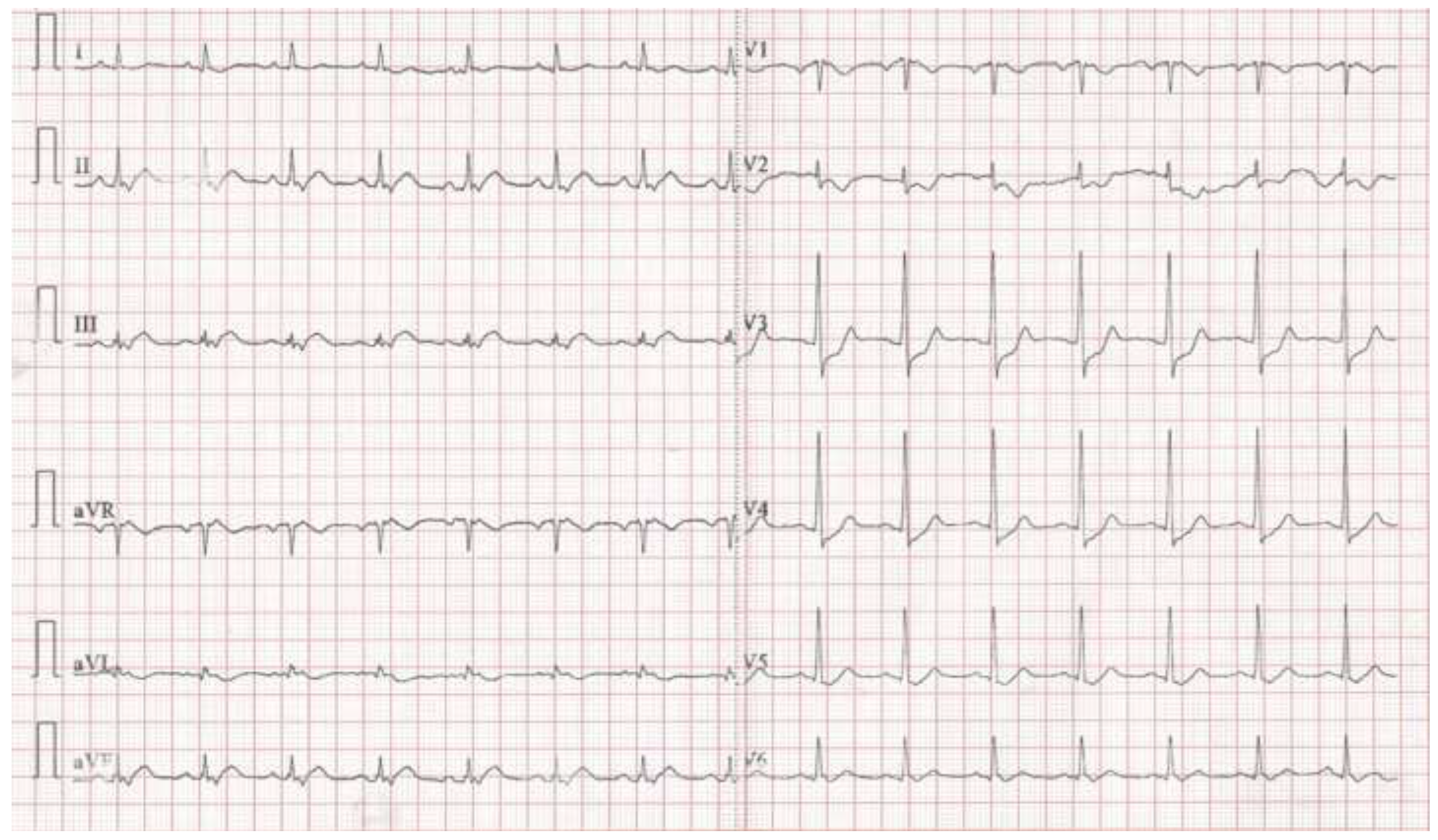 Cardiovascmed 25 00225 g001 Cardiovascmed 25 00225 g001