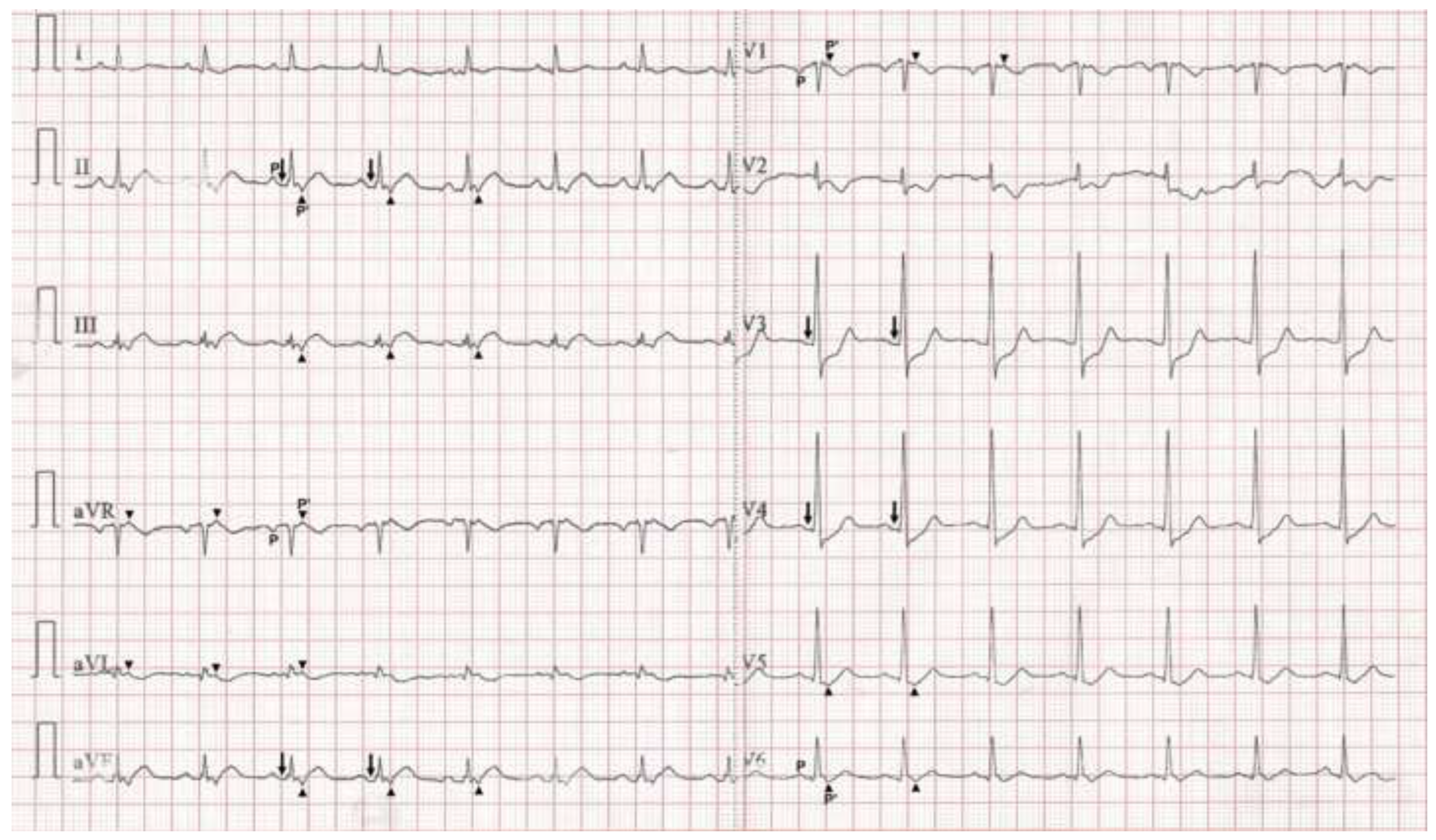 Cardiovascmed 25 00225 g002 Cardiovascmed 25 00225 g002
