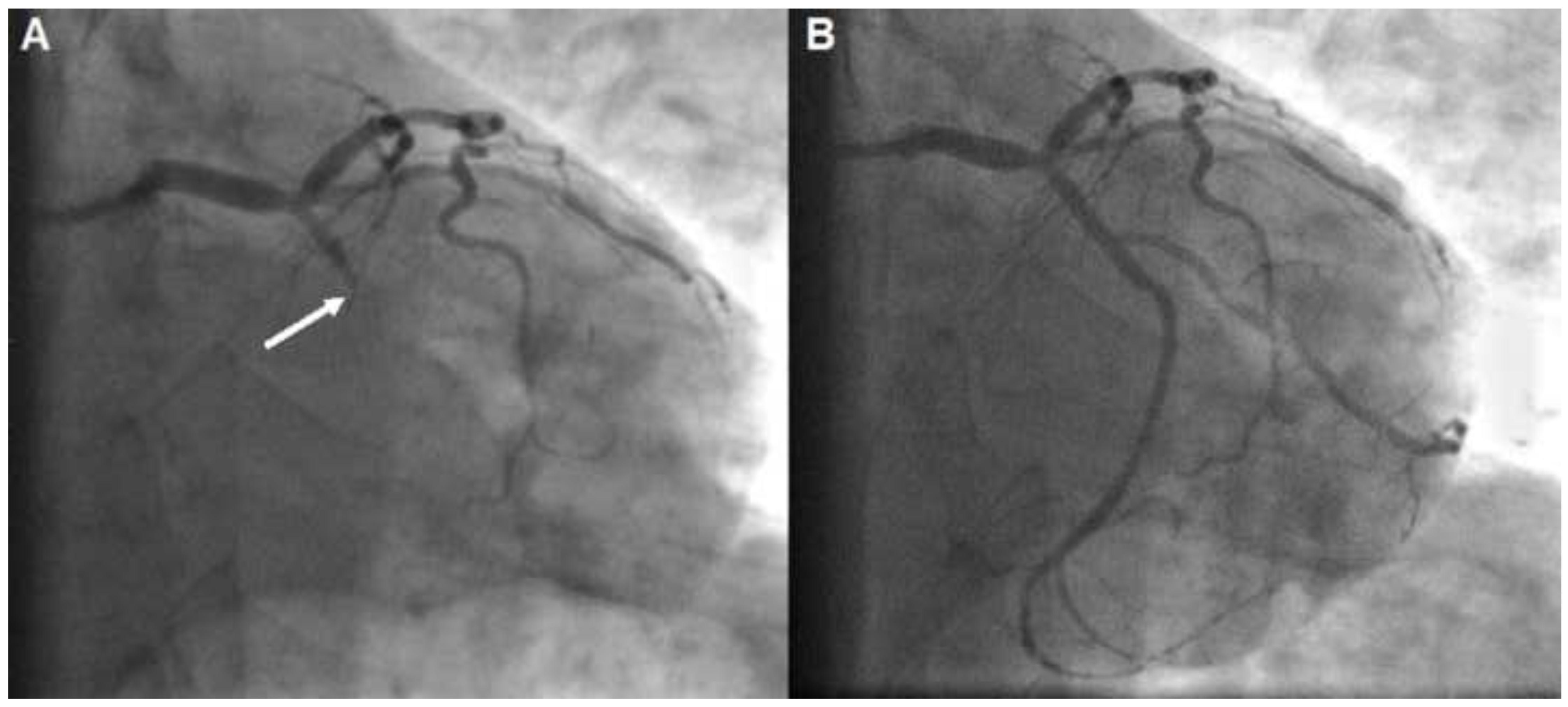 Cardiovascmed 25 00225 g003 Cardiovascmed 25 00225 g003