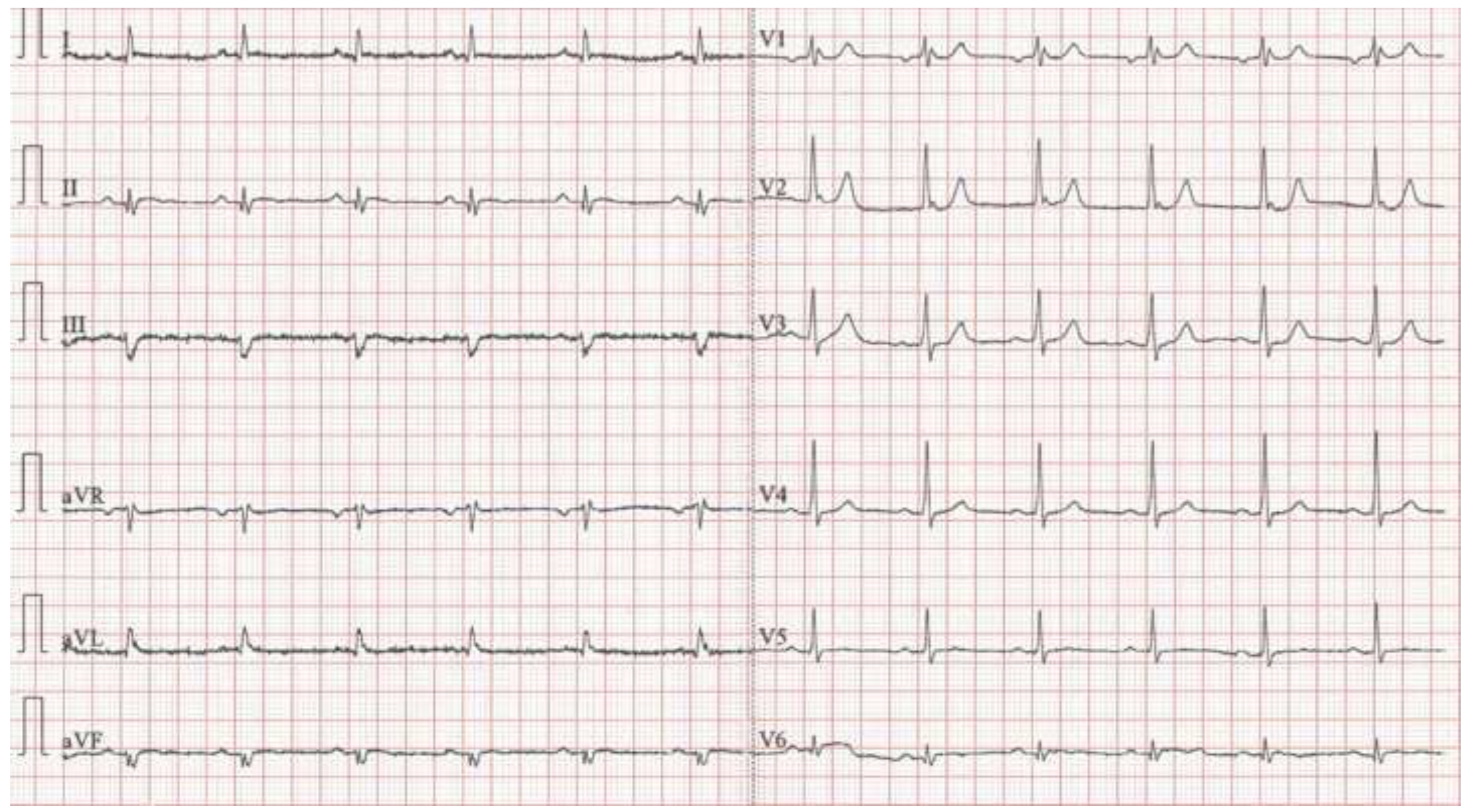 Cardiovascmed 25 00225 g004 Cardiovascmed 25 00225 g004