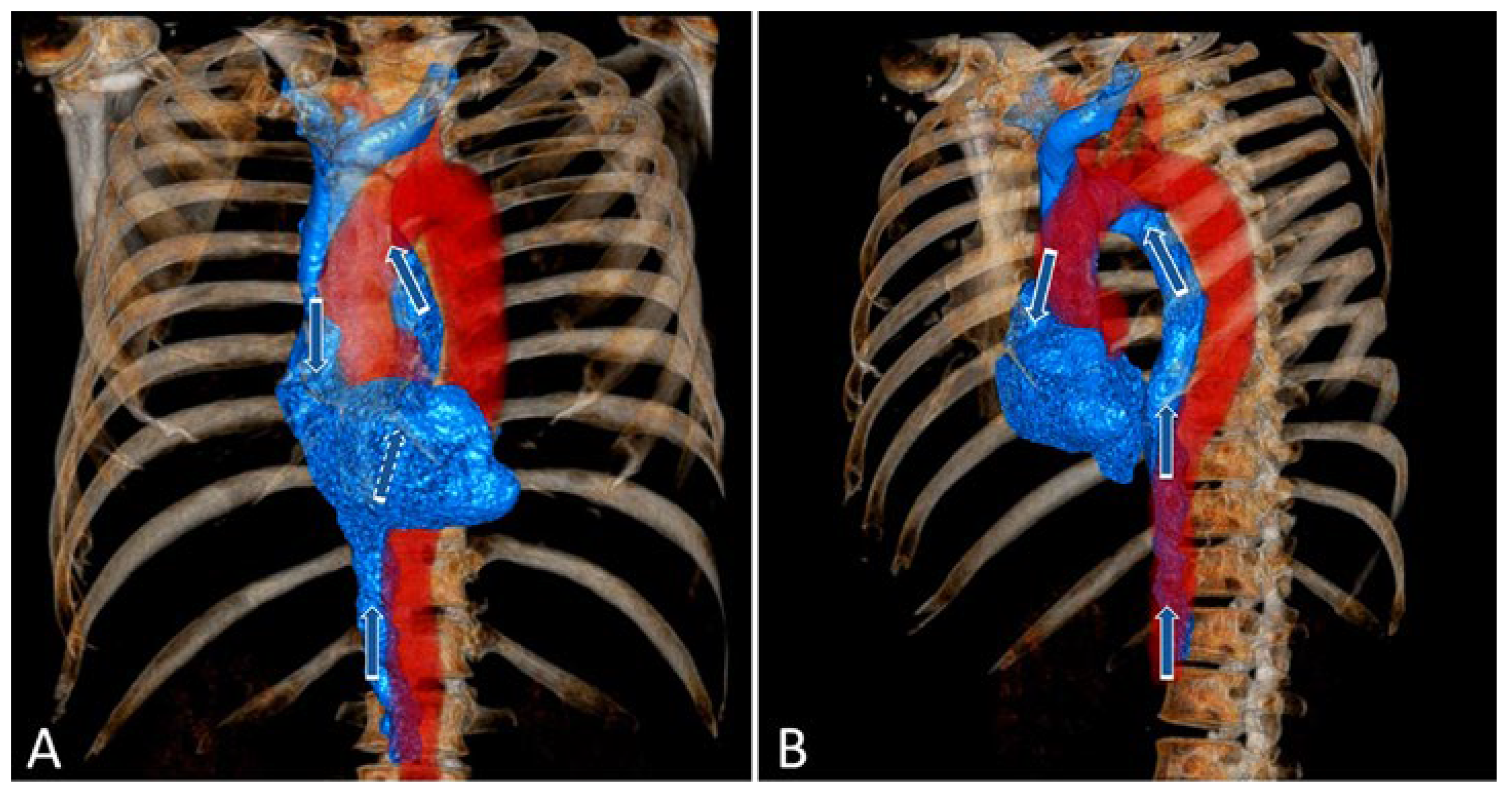 Cardiovascmed 25 02205 g001 Cardiovascmed 25 02205 g001