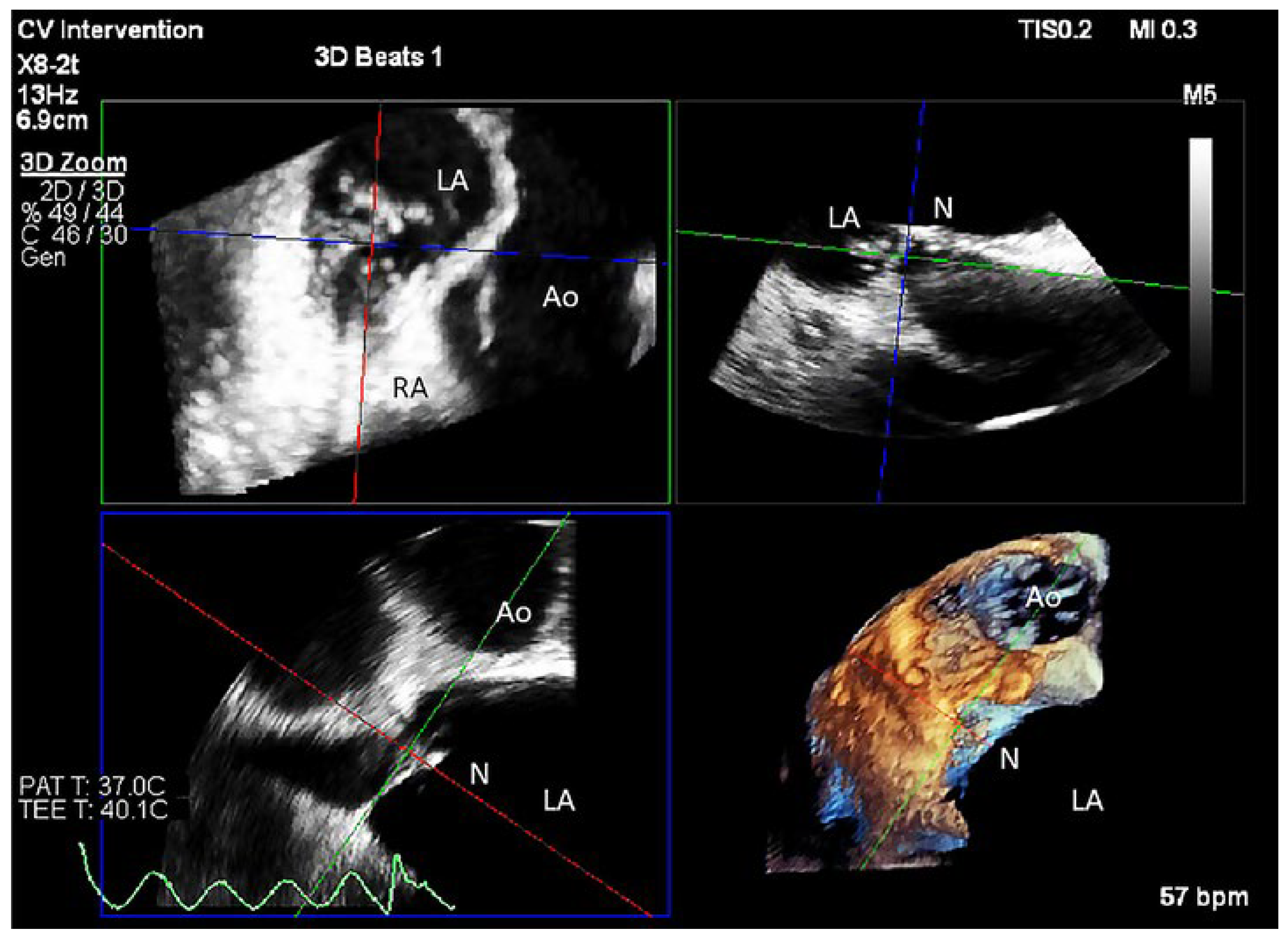 Cardiovascmed 25 02205 g003 Cardiovascmed 25 02205 g003
