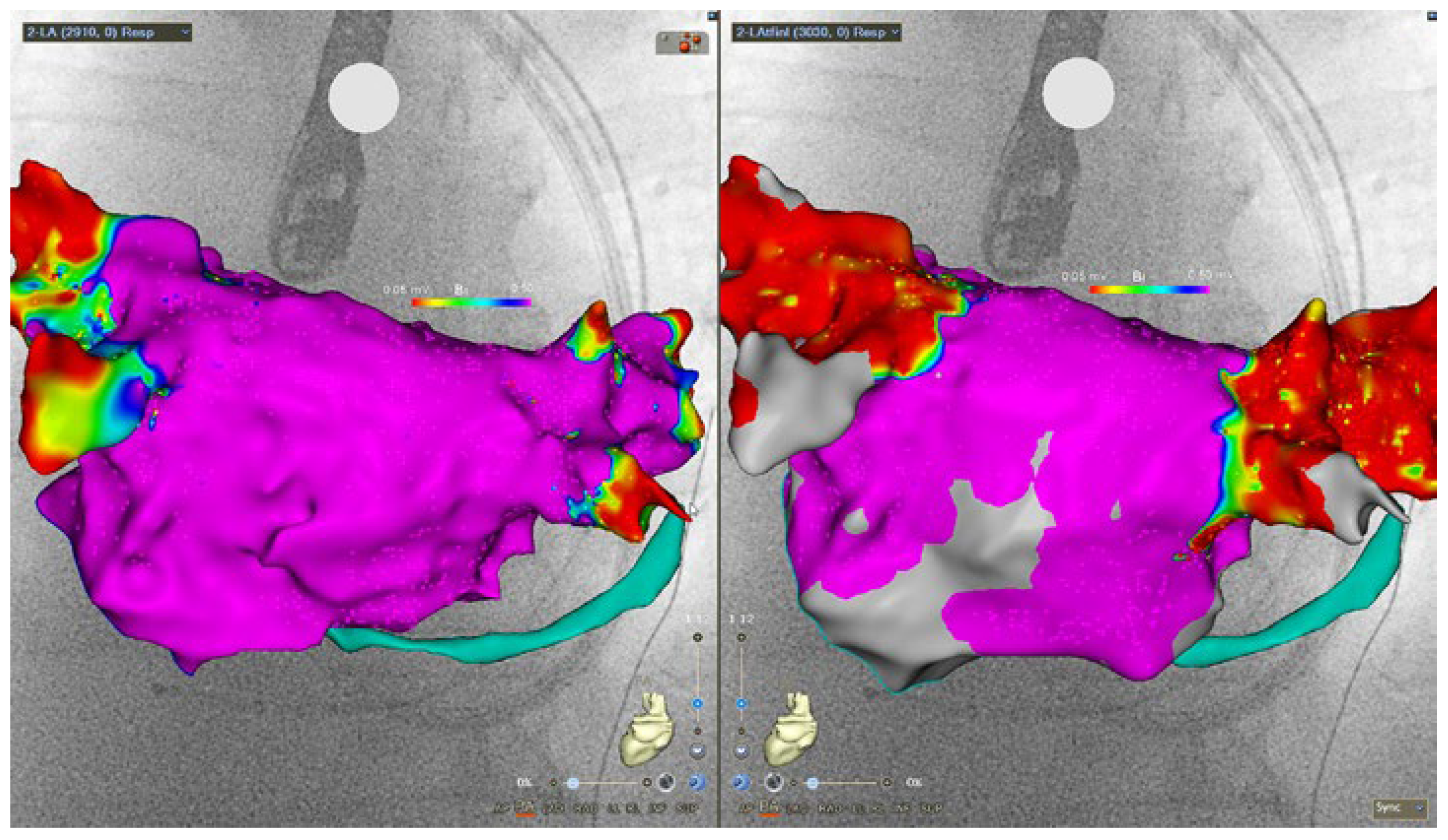 Cardiovascmed 25 02205 g004 Cardiovascmed 25 02205 g004