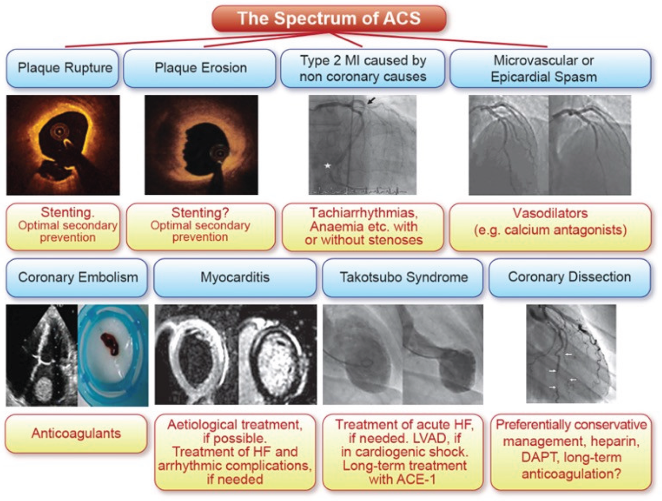 Cardiovascmed 26 00001 g001