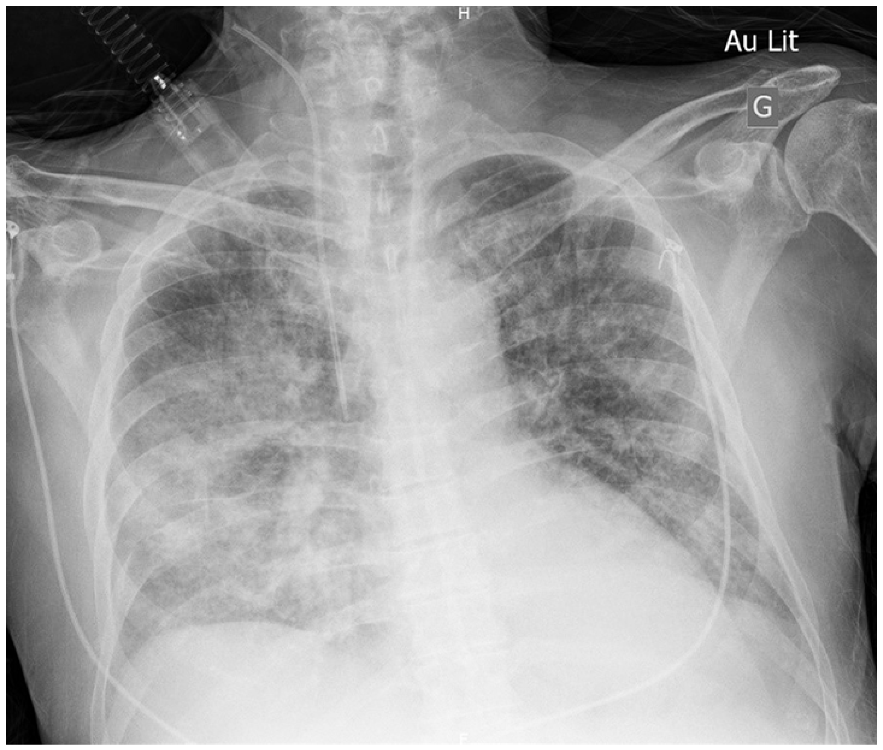 Cardiovascmed 26 00020 g002