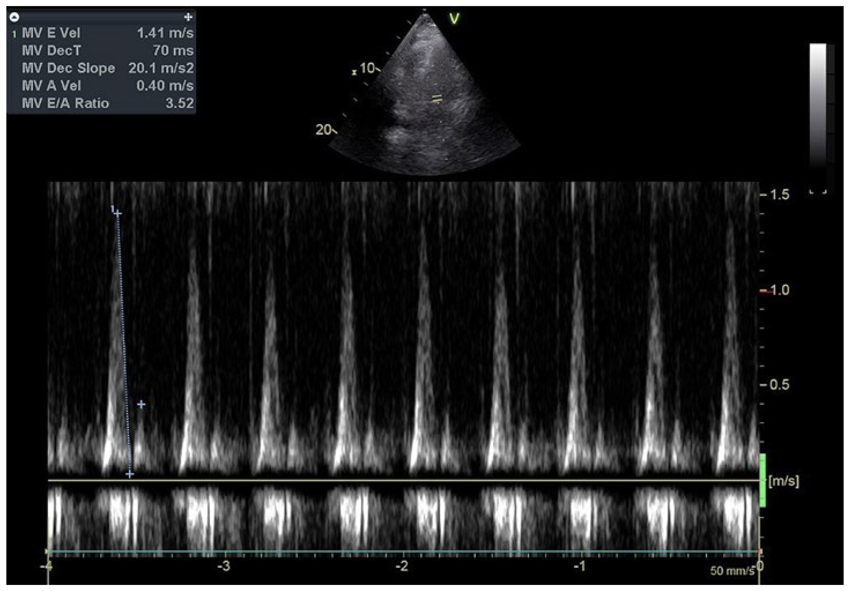 Cardiovascmed 26 00020 g004