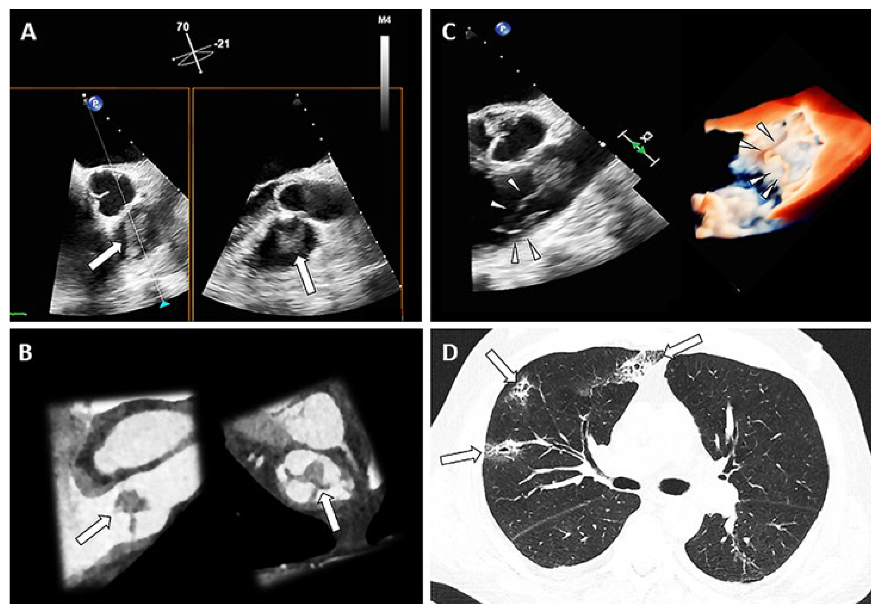 Cardiovascmed 26 00034 g001