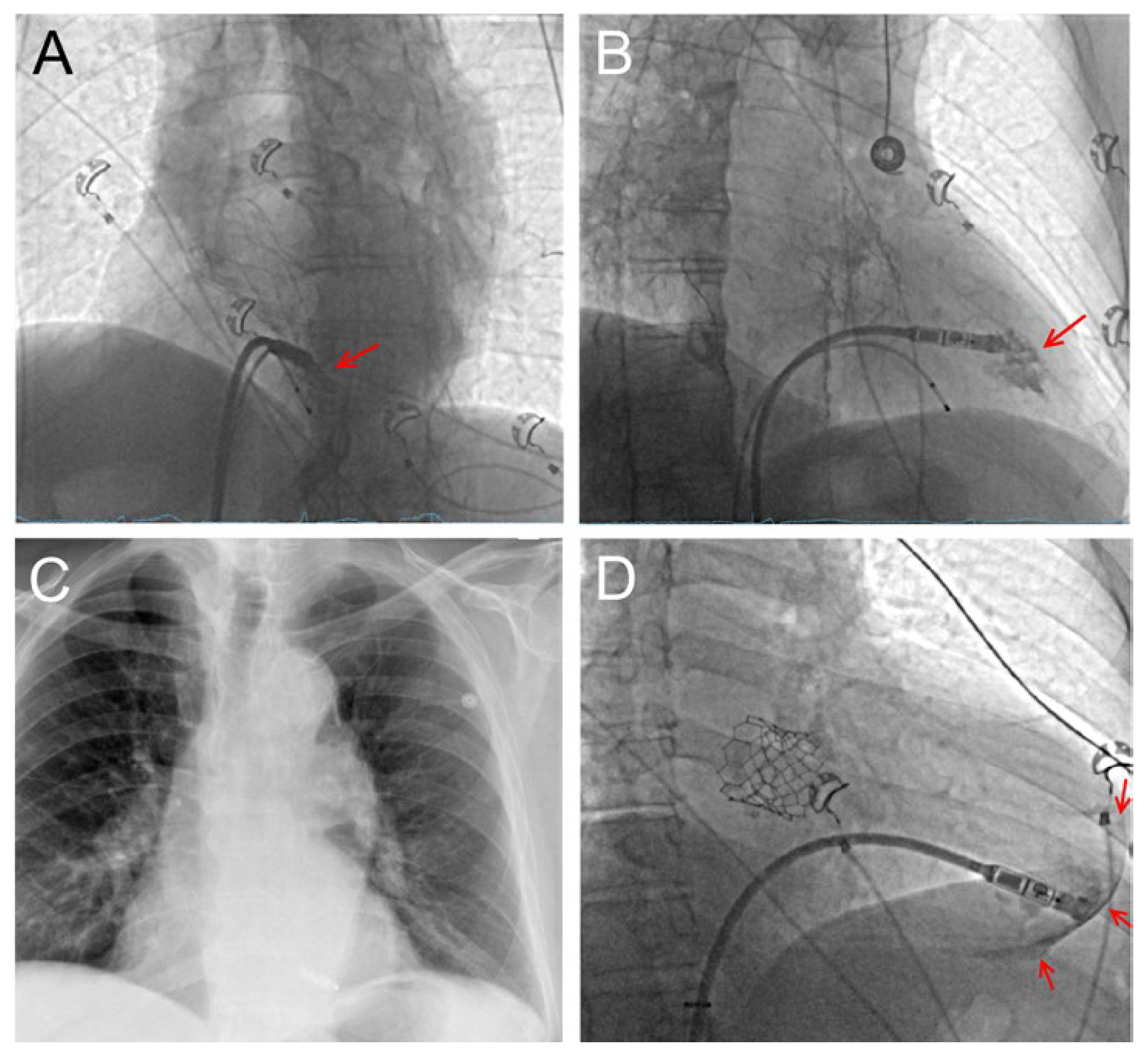 Cardiovascmed 26 00046 g001