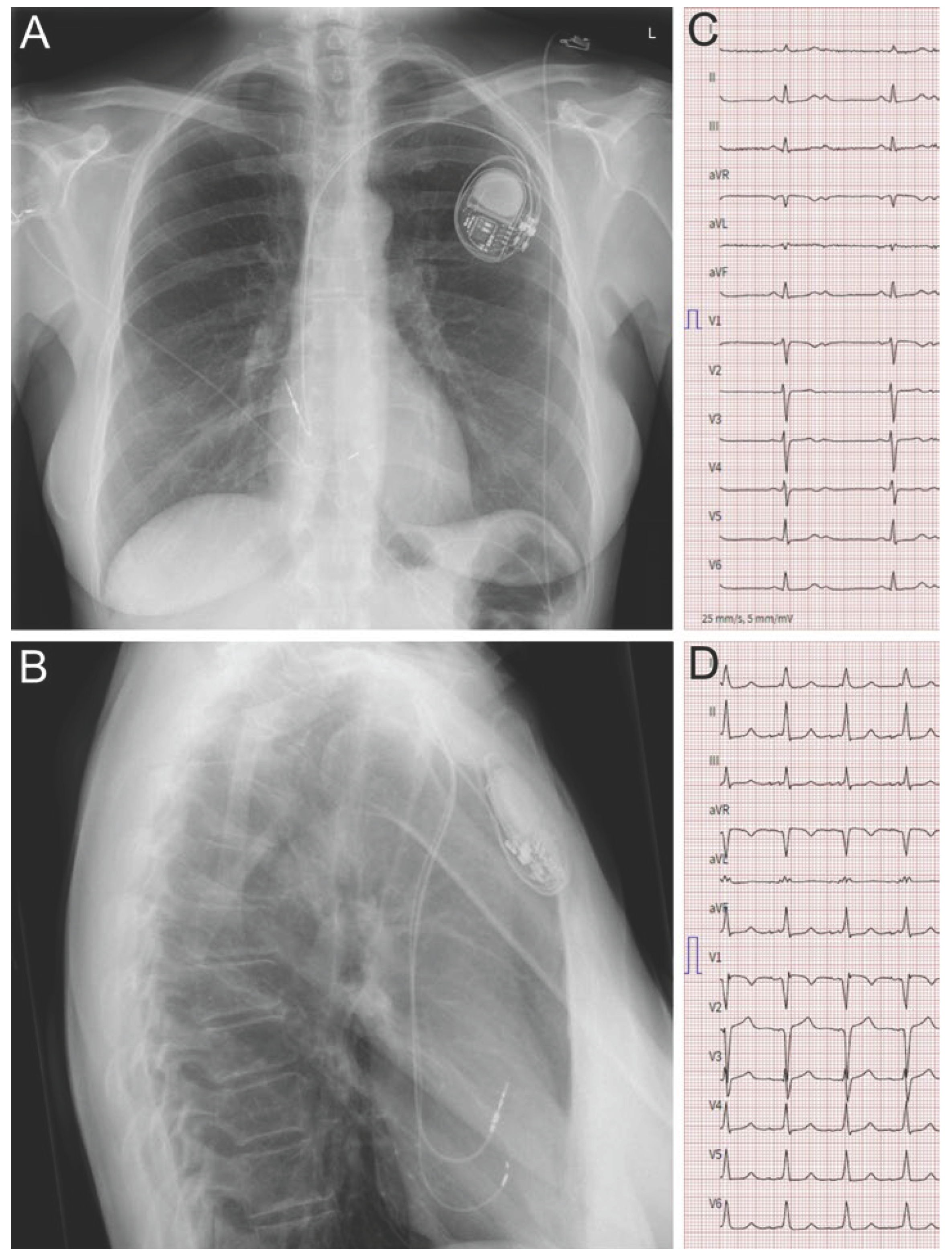 Cardiovascmed 26 00046 g002