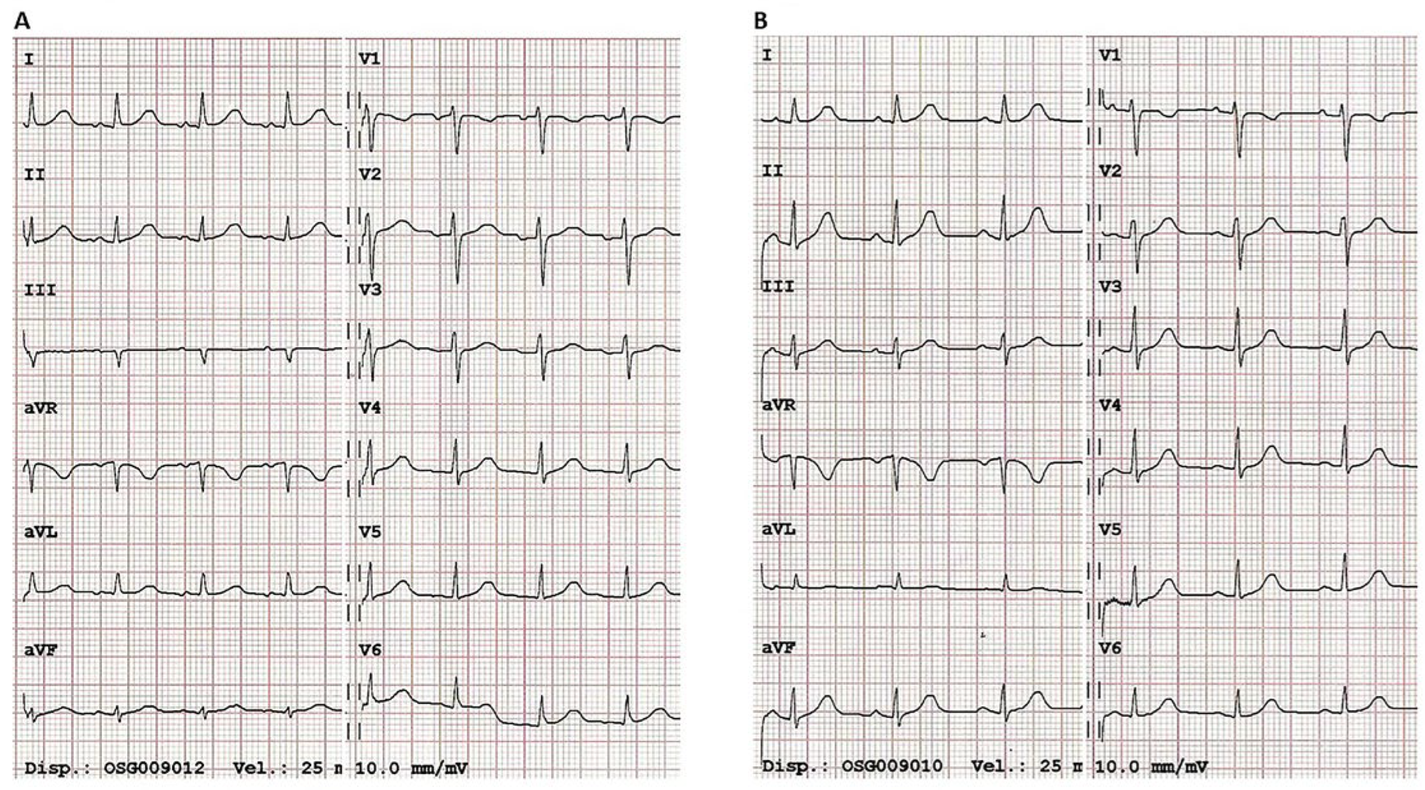 Cardiovascmed 26 00060 g001