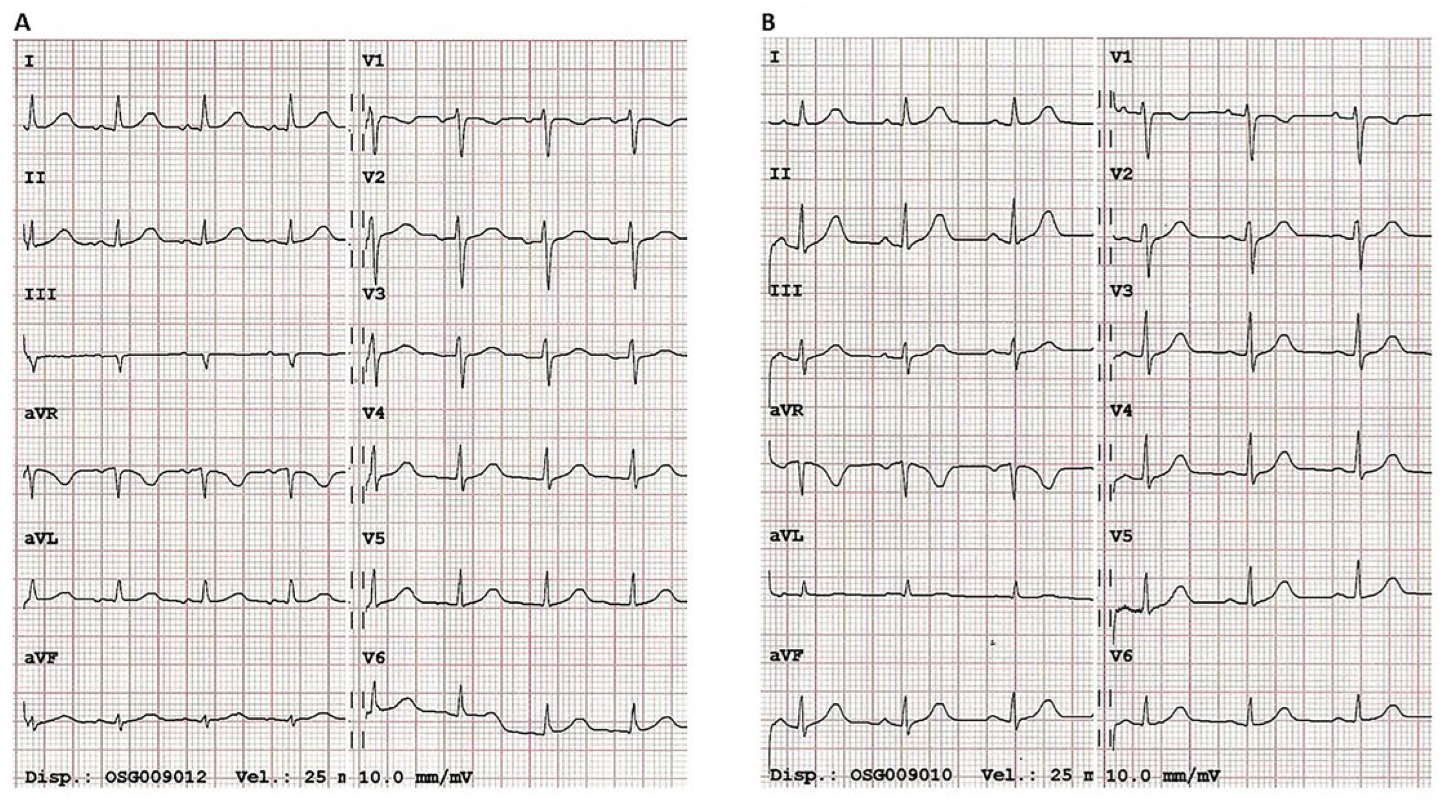 Cardiovascmed 26 00060 g002