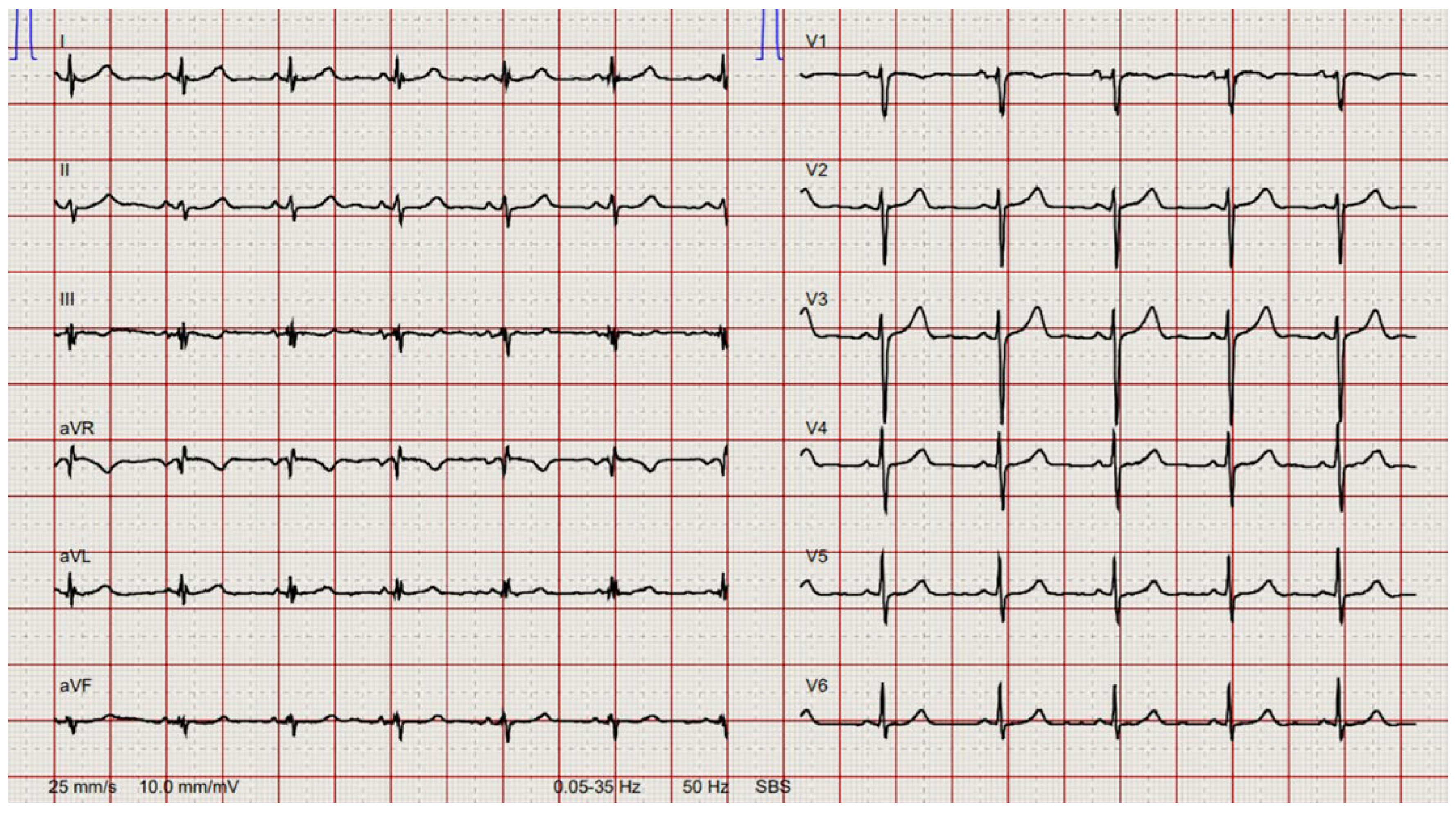 Cardiovascmed 26 00133 g001