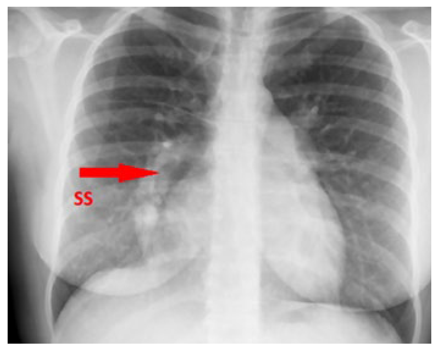 Cardiovascmed 26 00133 g002