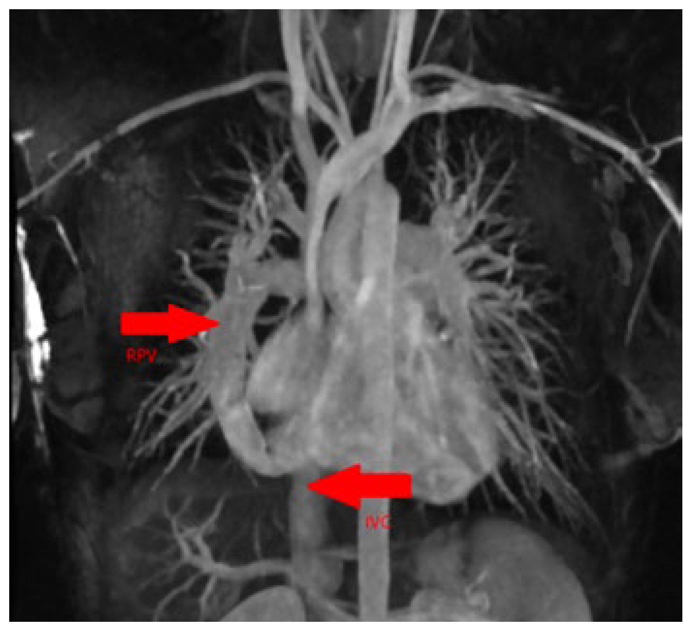 Cardiovascmed 26 00133 g004