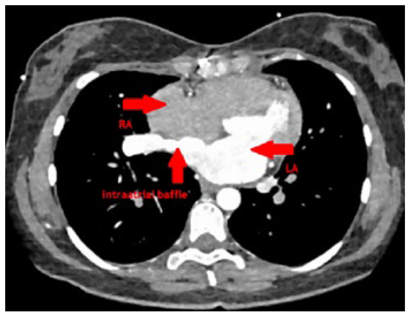 Cardiovascmed 26 00133 g005