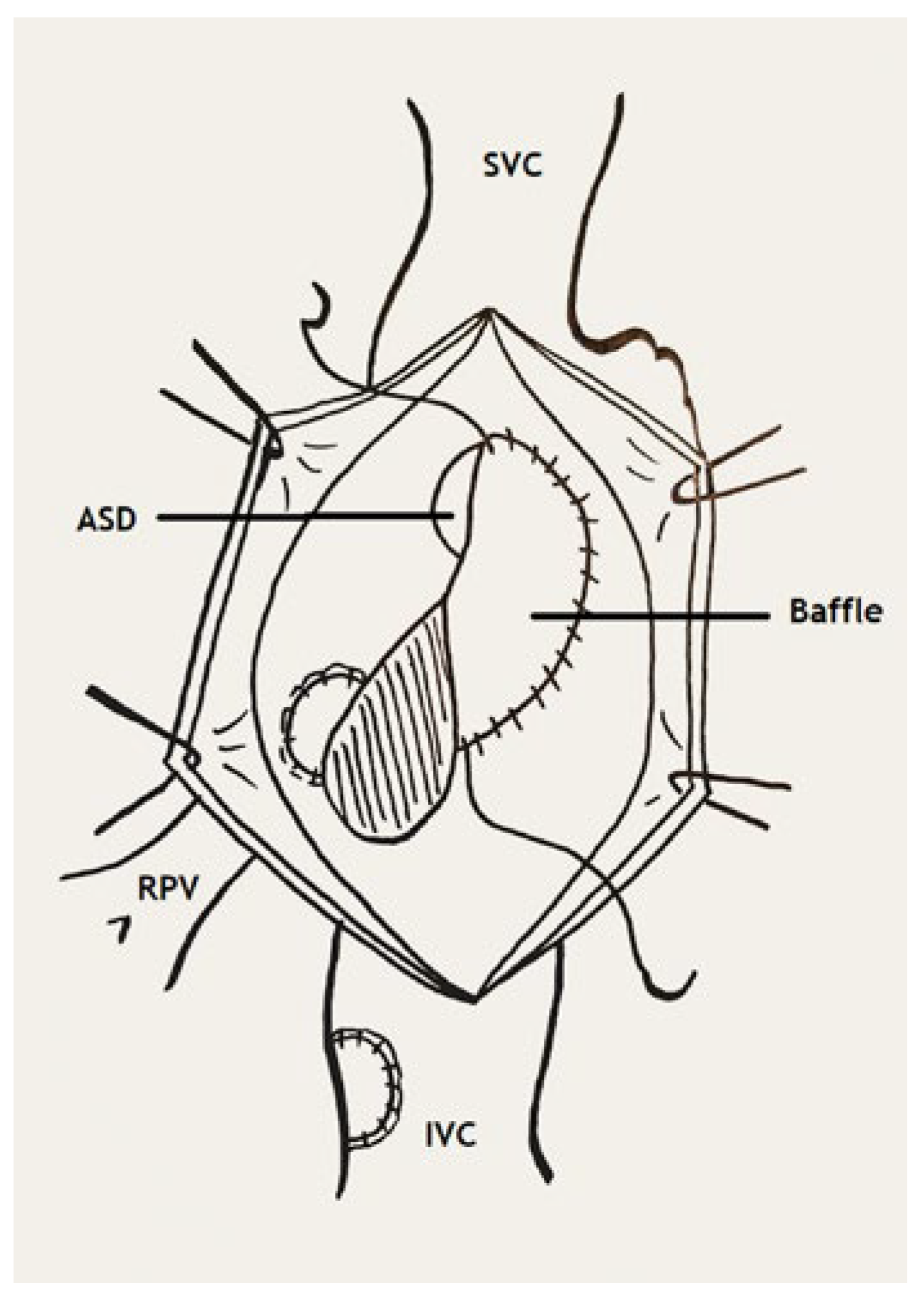 Cardiovascmed 26 00133 g006
