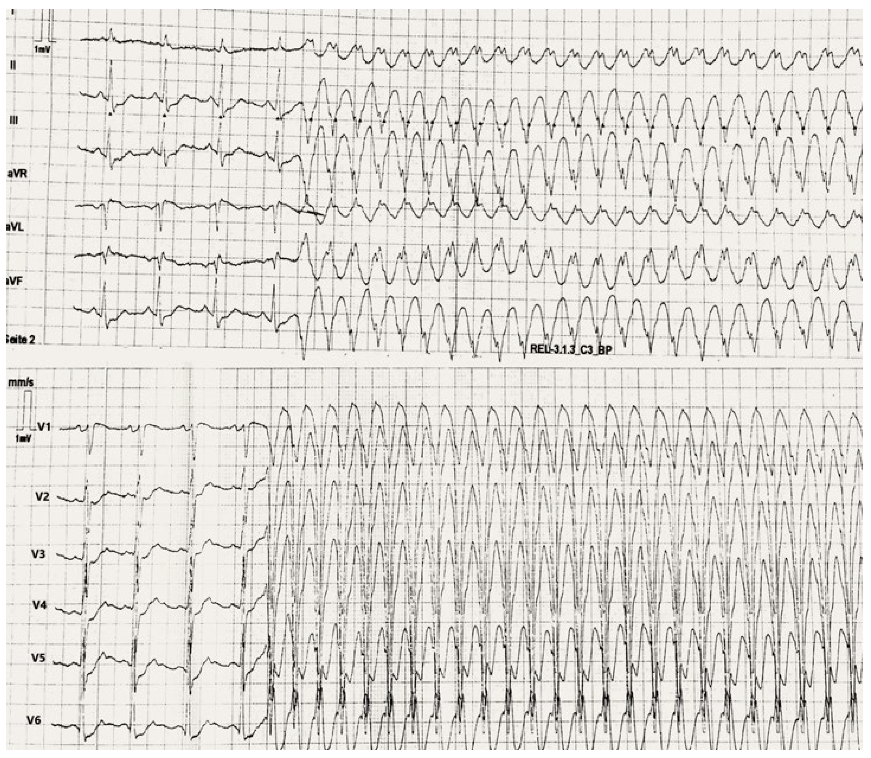 Cardiovascmed 26 00136 g001