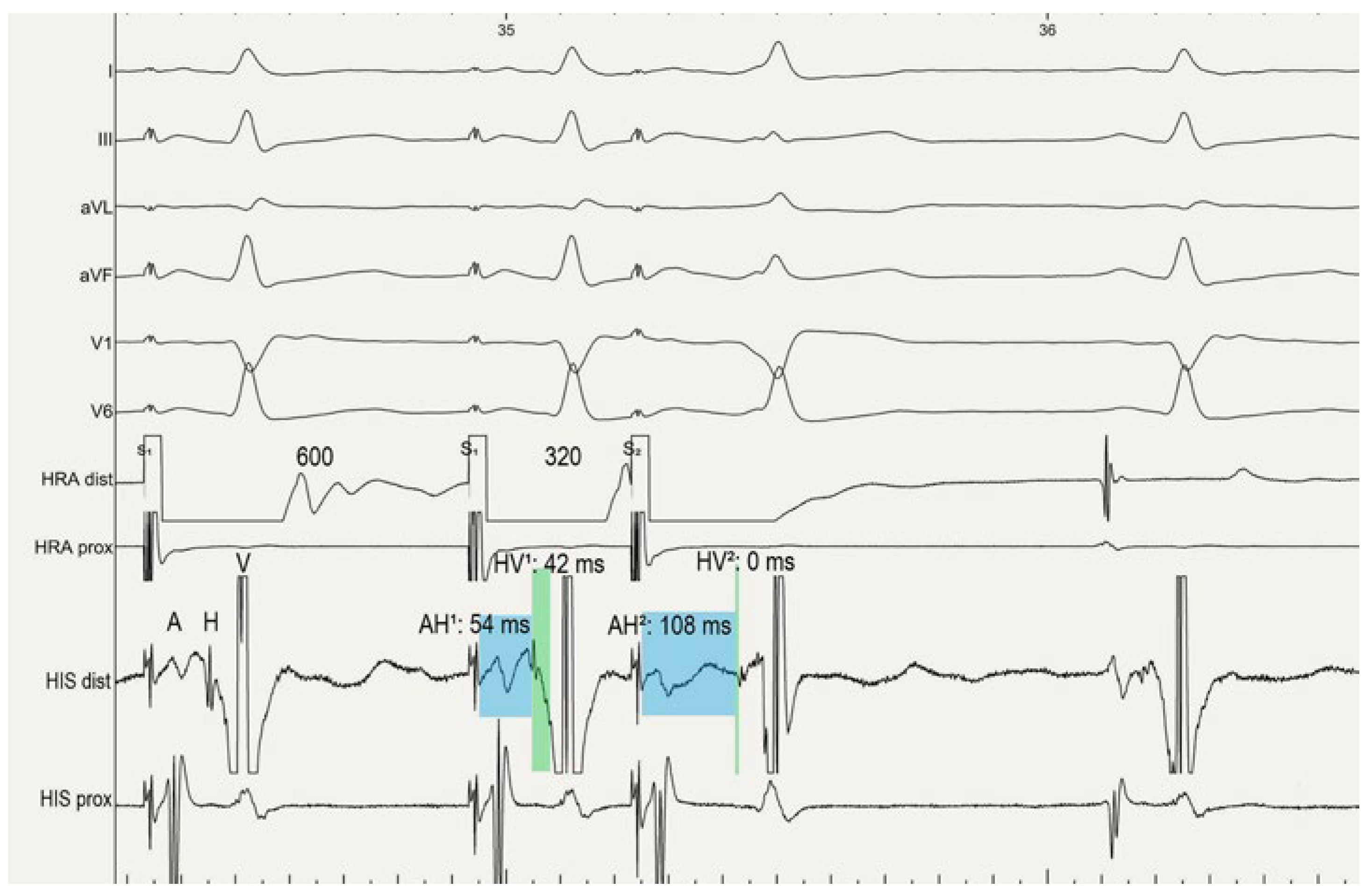 Cardiovascmed 26 00136 g002