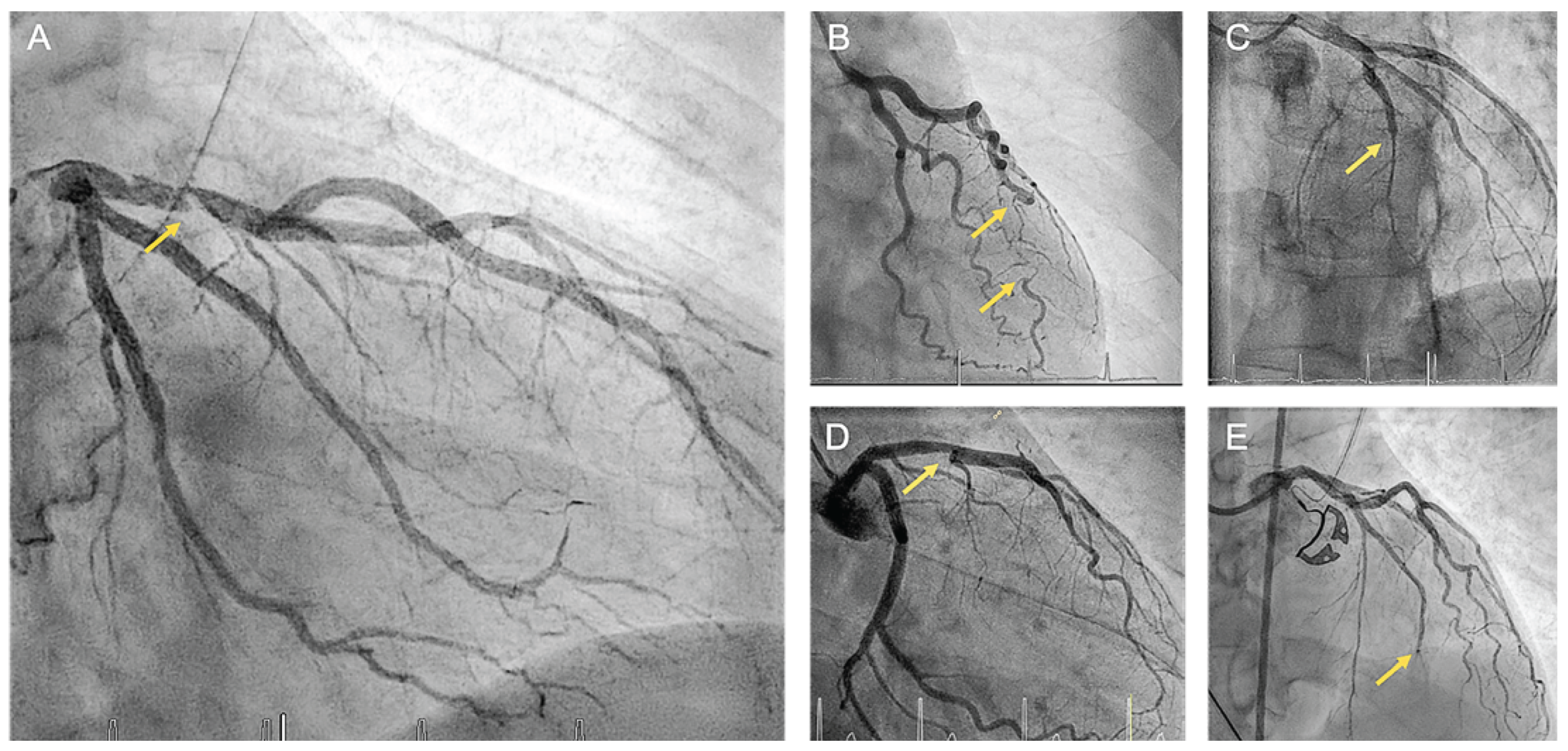 Cardiovascmed 26 00160 g003