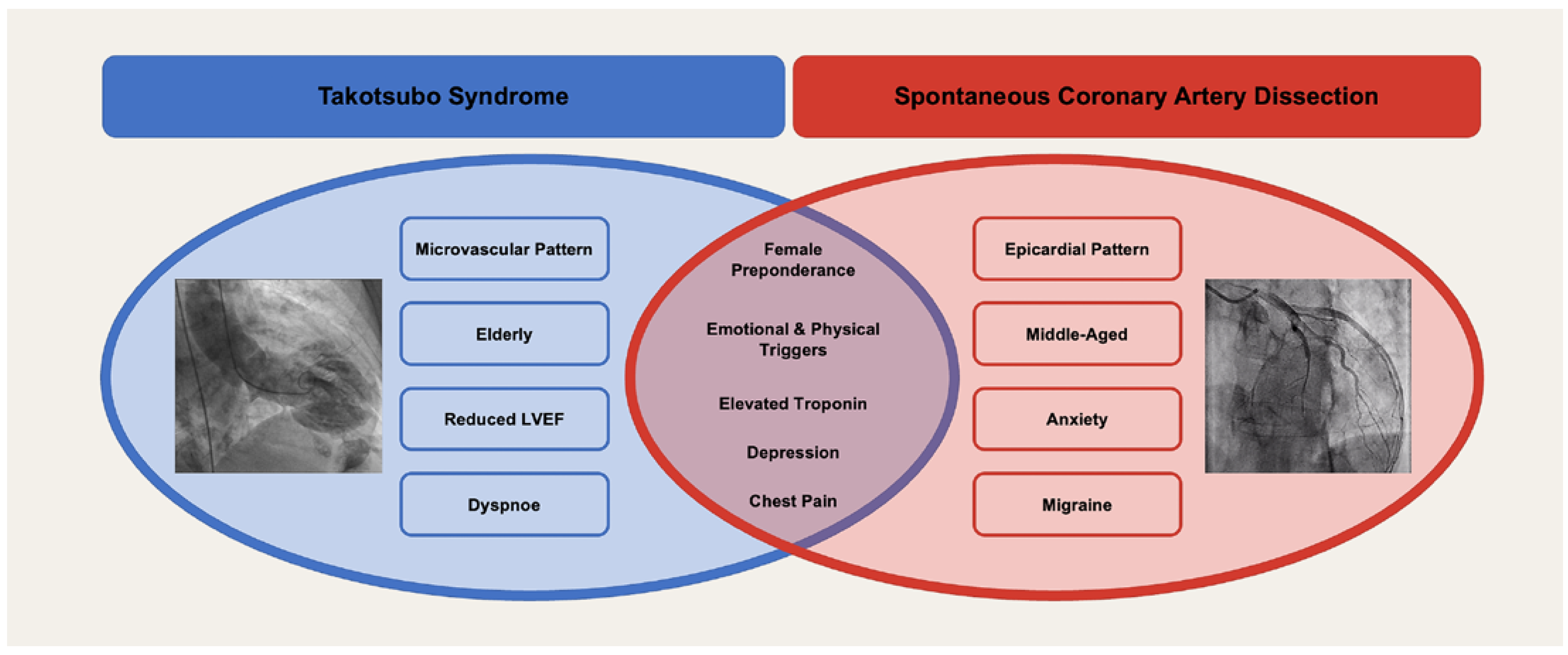 Cardiovascmed 26 00160 g004