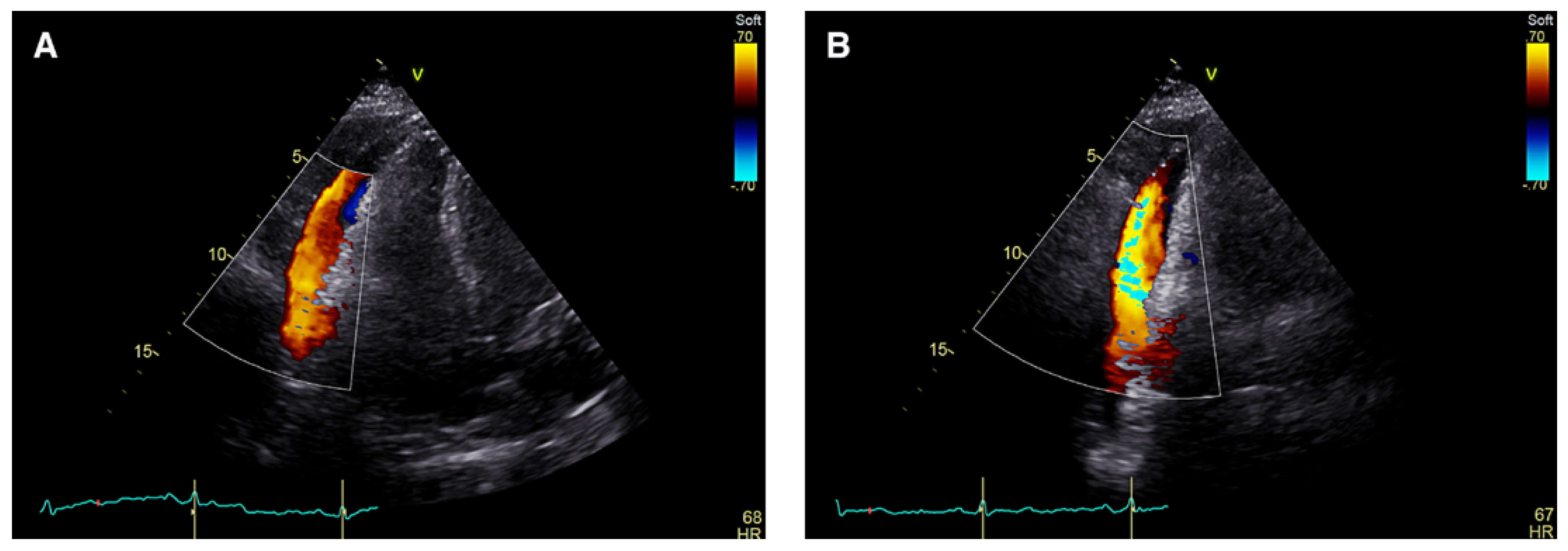 Cardiovascmed 26 00174 g001 Cardiovascmed 26 00174 g001