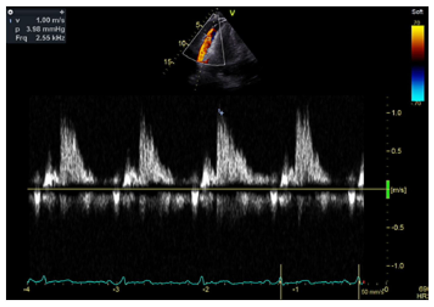 Cardiovascmed 26 00174 g002 Cardiovascmed 26 00174 g002