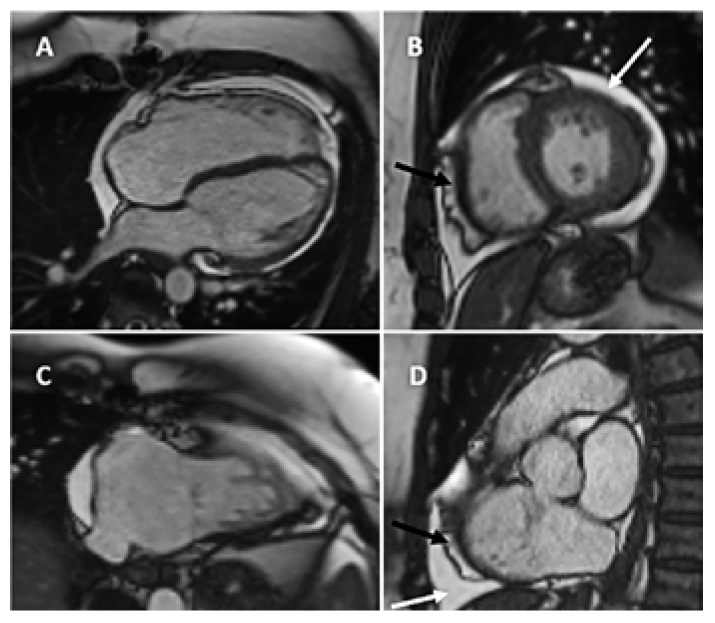 Cardiovascmed 26 00174 g003 Cardiovascmed 26 00174 g003
