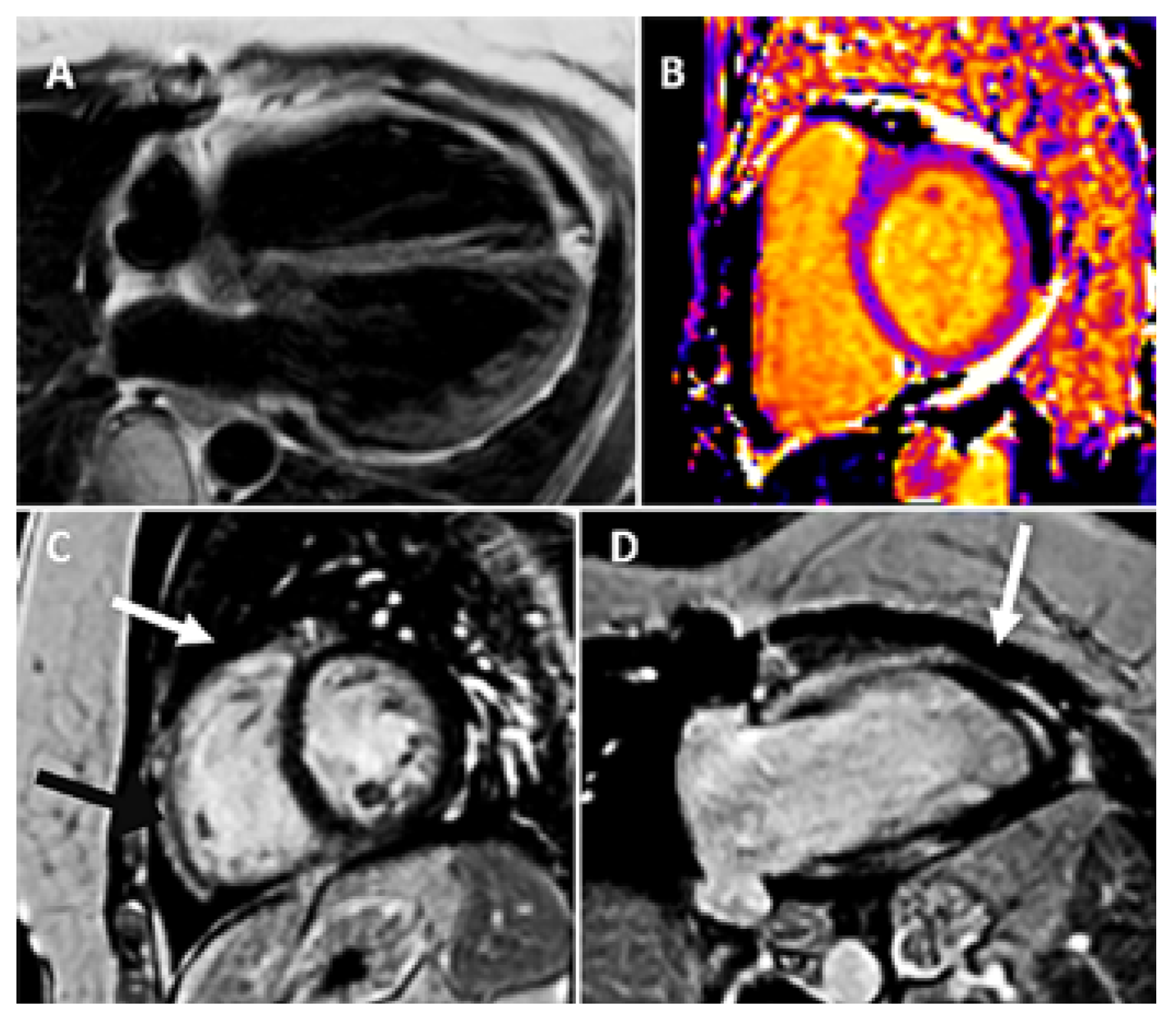 Cardiovascmed 26 00174 g004 Cardiovascmed 26 00174 g004