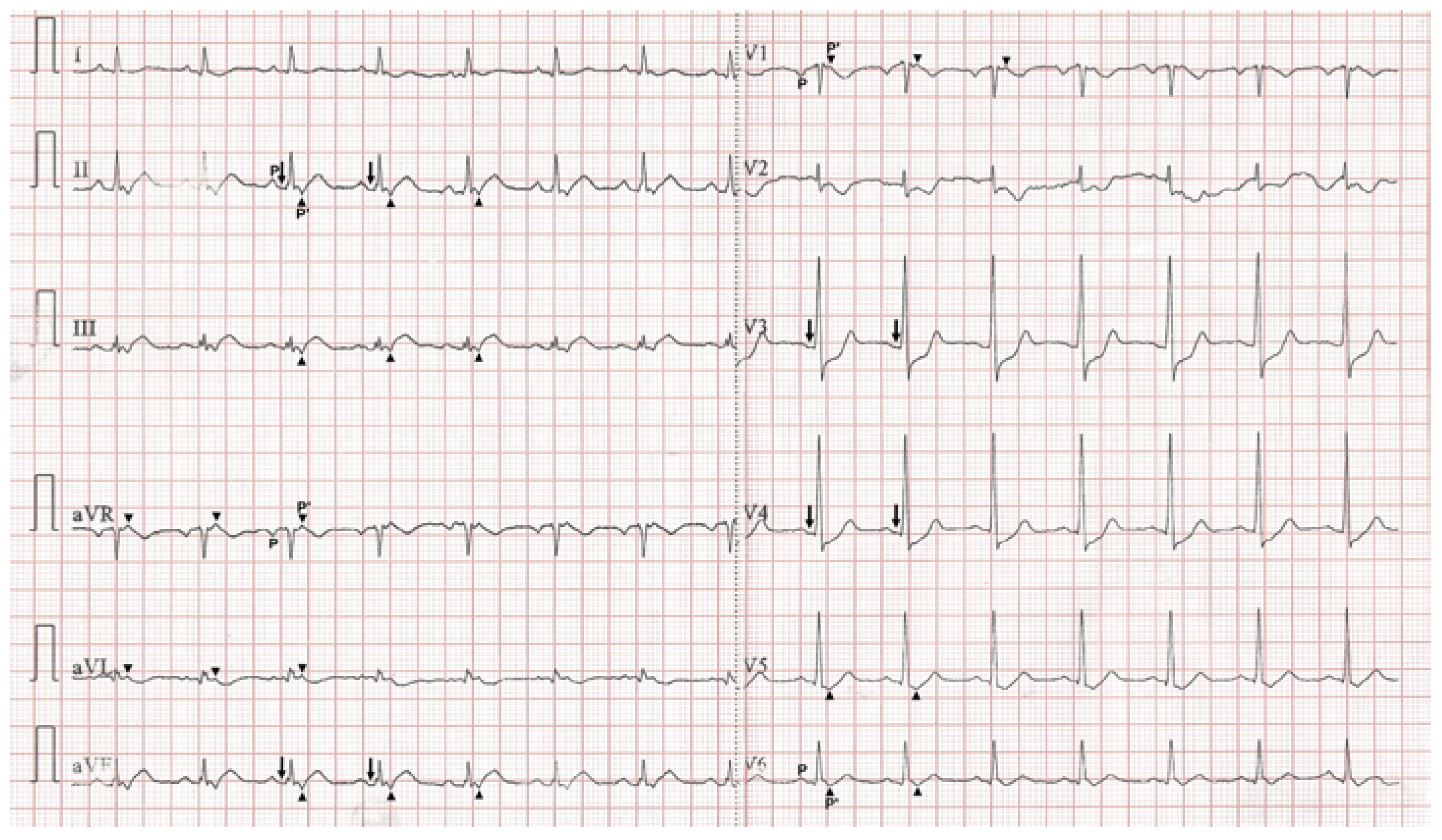 Cardiovascmed 26 00176 g002