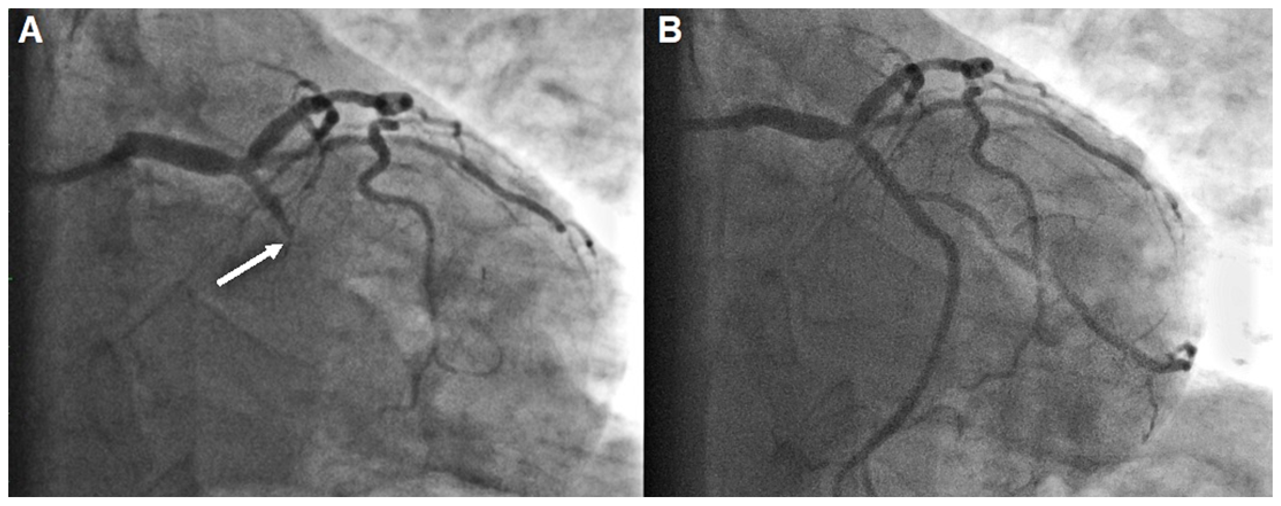 Cardiovascmed 26 00176 g003