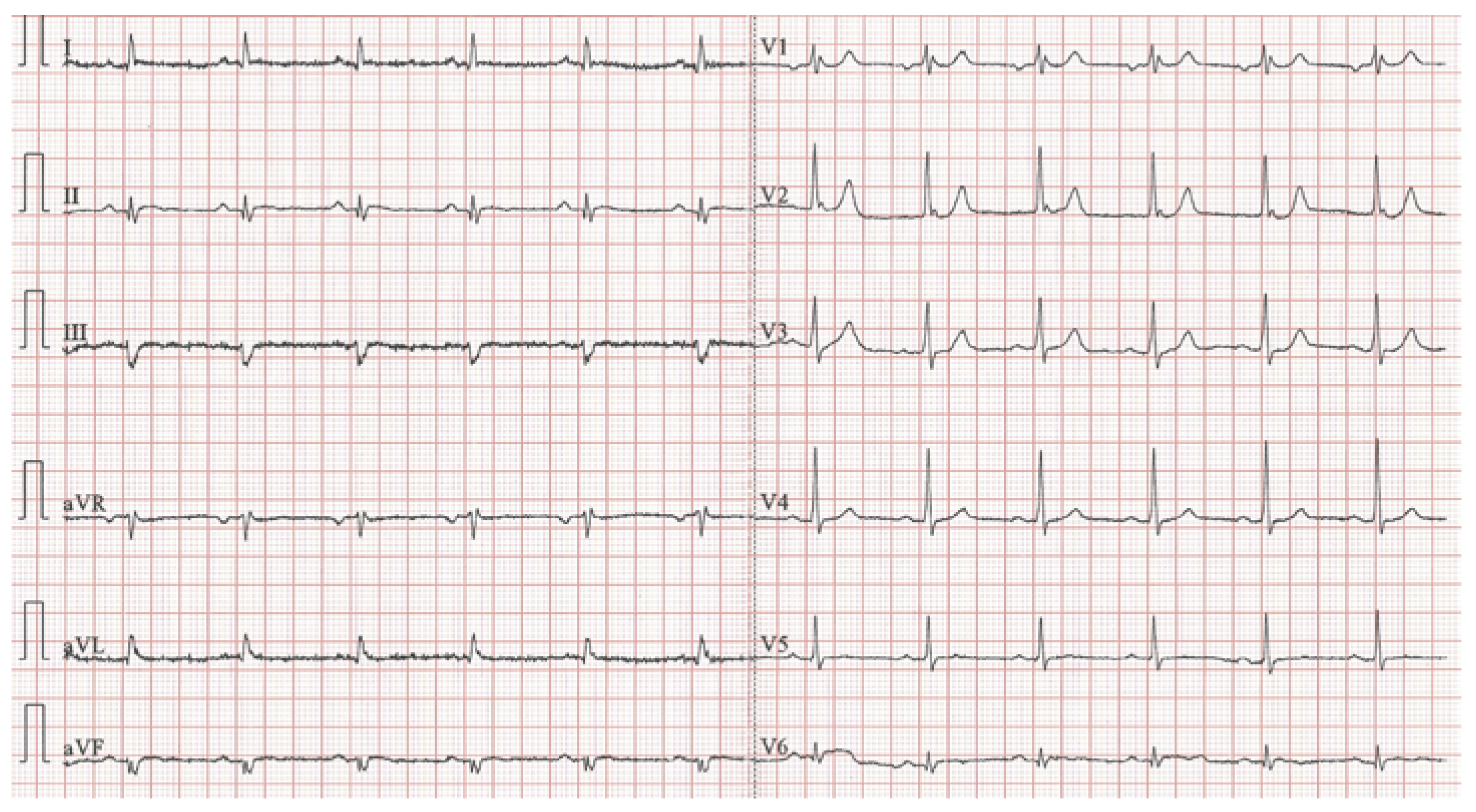 Cardiovascmed 26 00176 g004