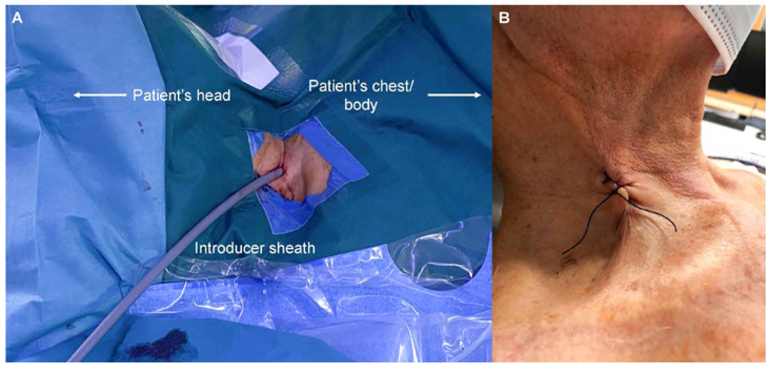 Cardiovascmed 26 00194 g001