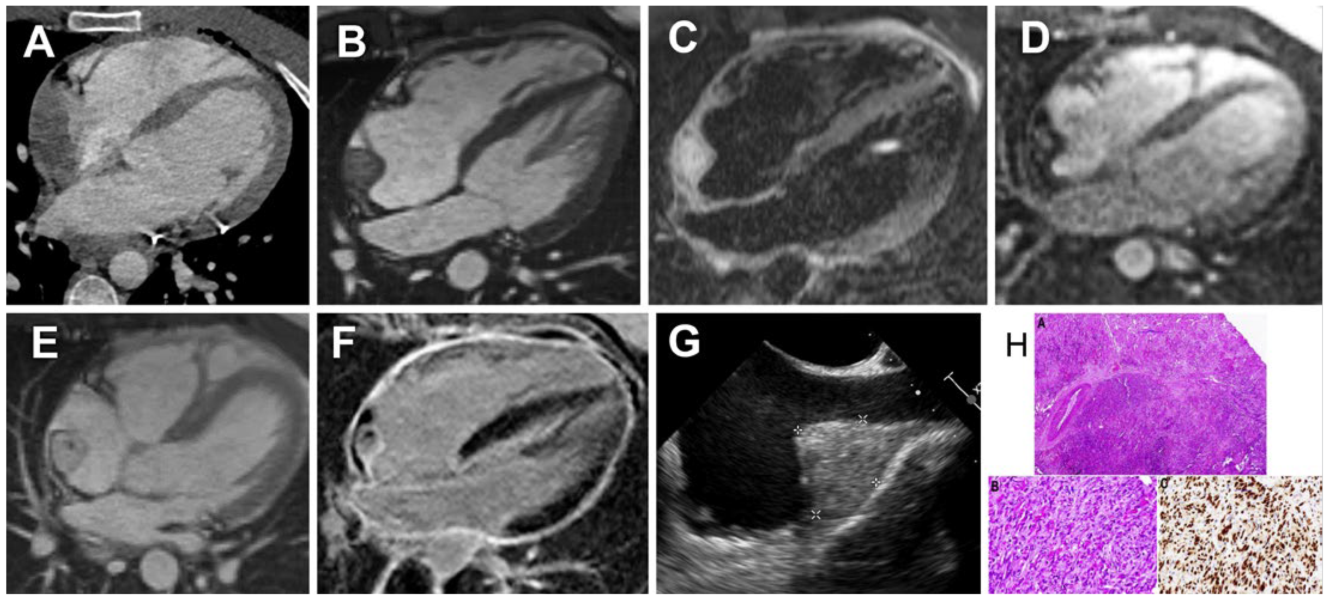 Cardiovascmed 26 02223 g001