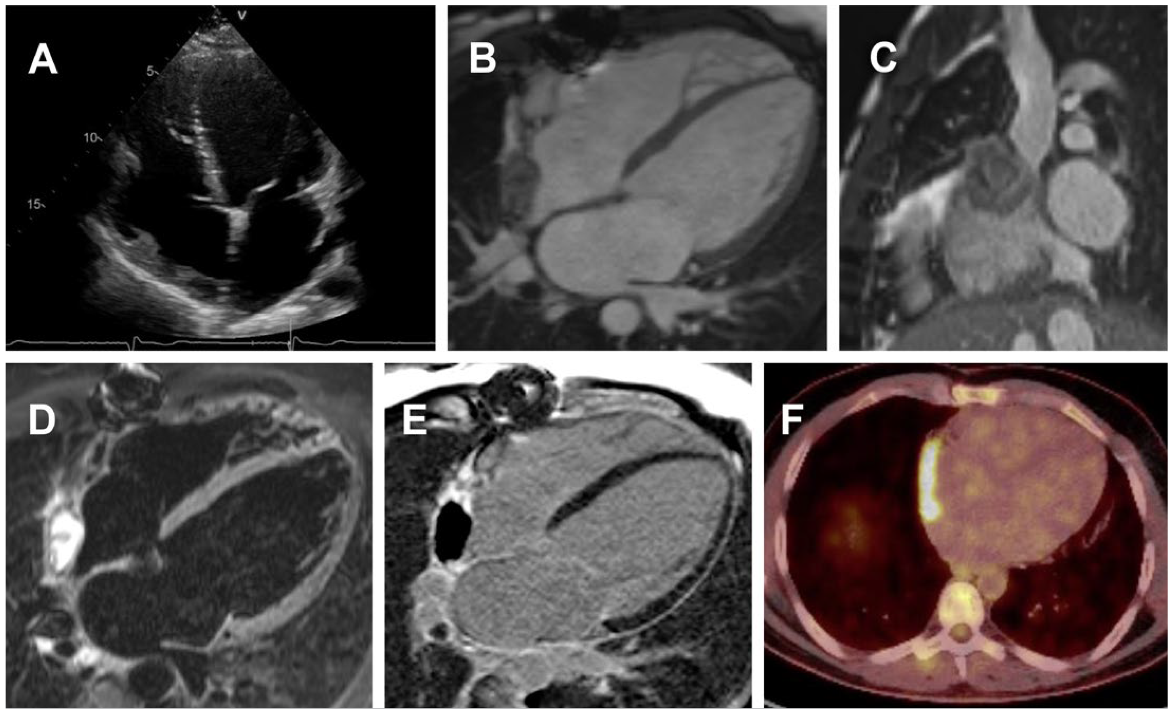 Cardiovascmed 26 02223 g002