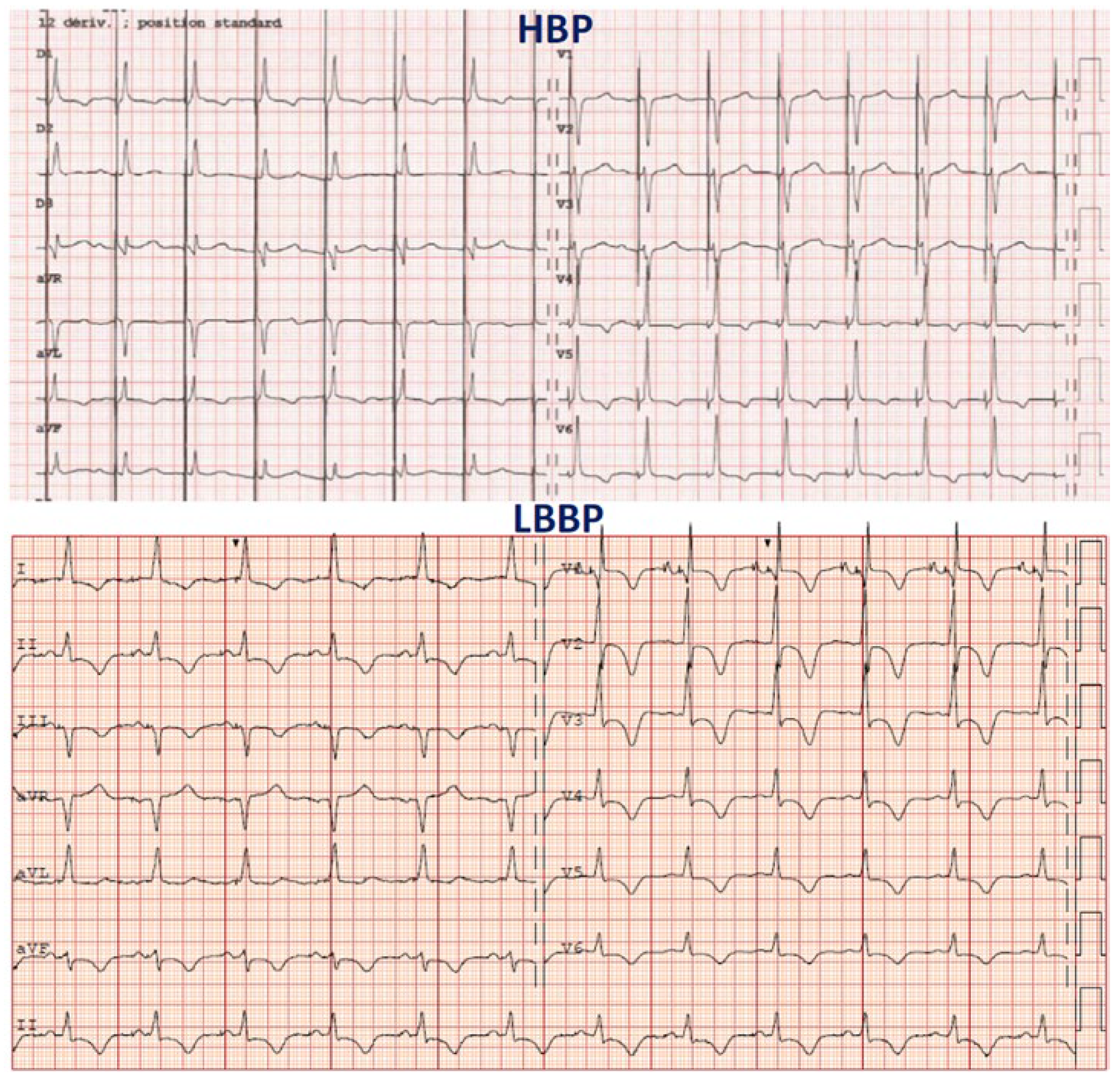 Cardiovascmed 27 00085 g003 Cardiovascmed 27 00085 g003