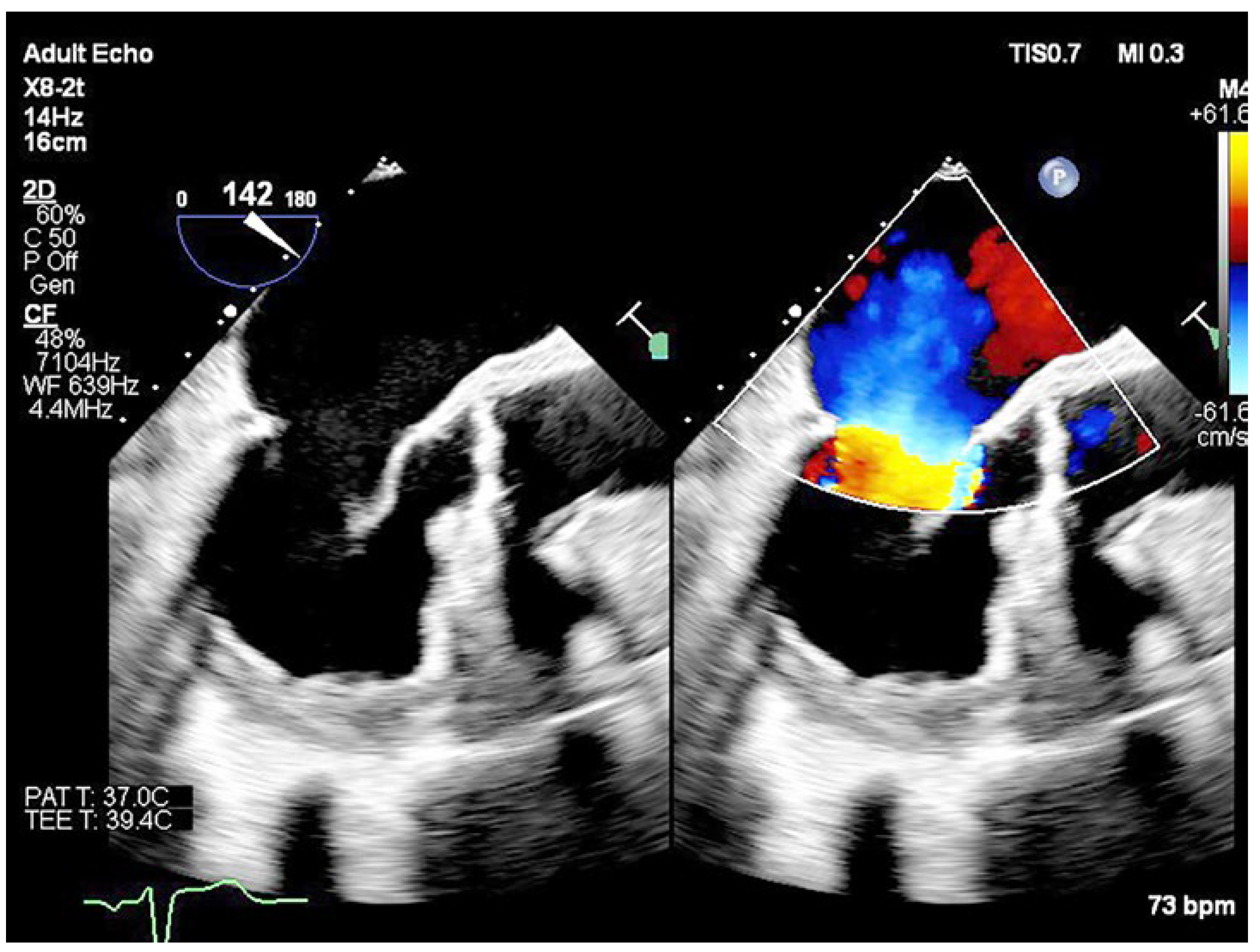 Cardiovascmed 27 00114 g001